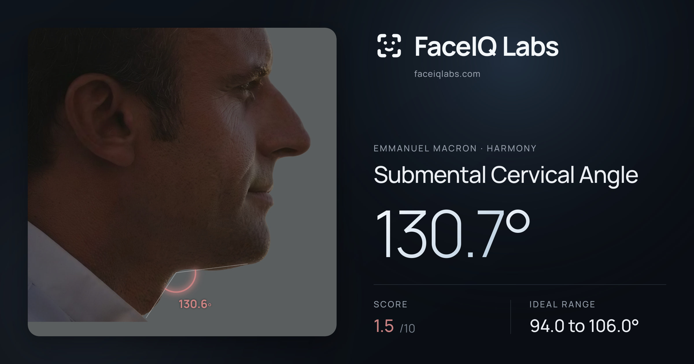 Emmanuel Macron Submental Cervical Angle: 130.7°, drawn on the photo