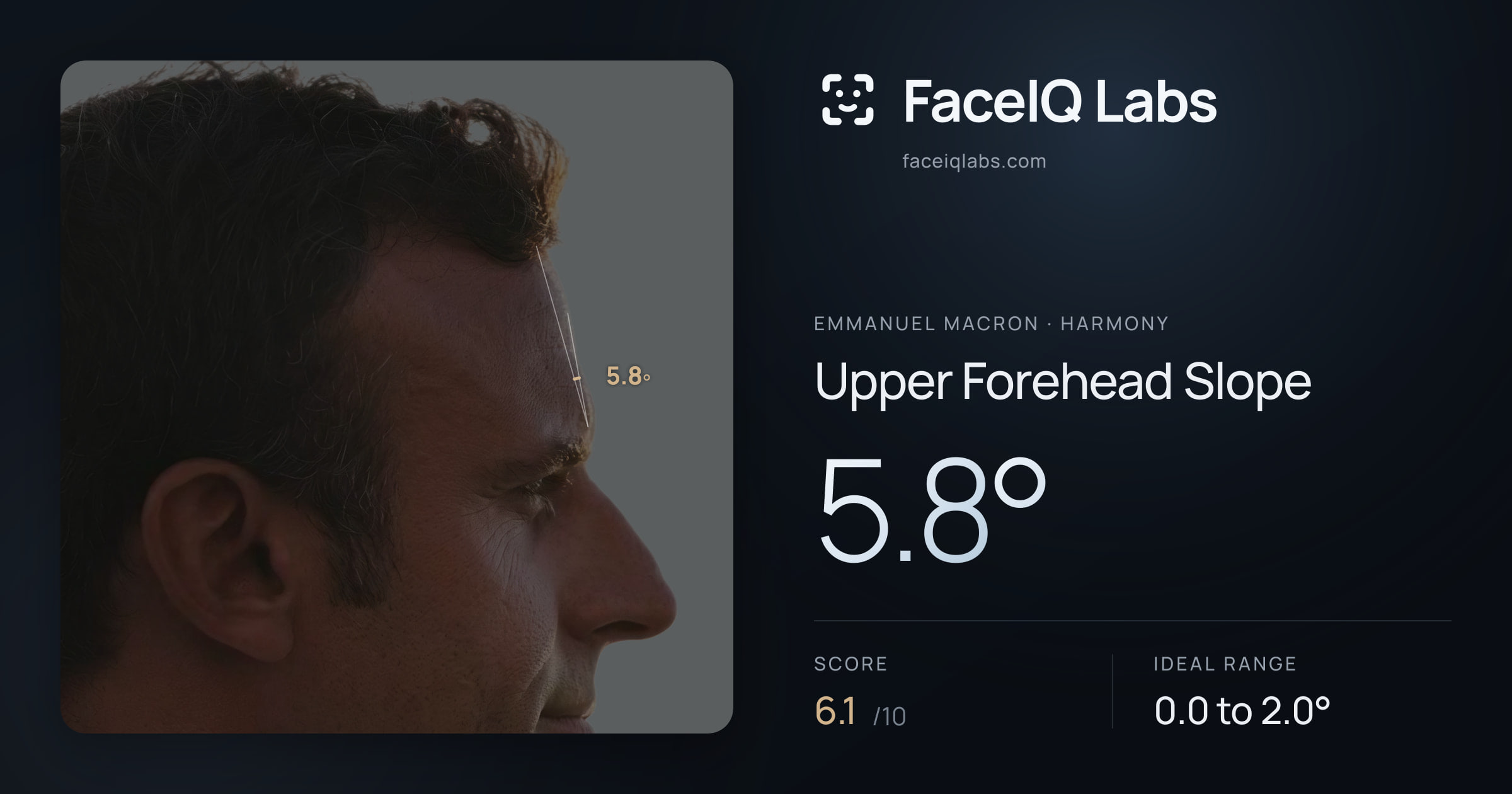Emmanuel Macron Upper Forehead Slope: 5.8°, drawn on the photo