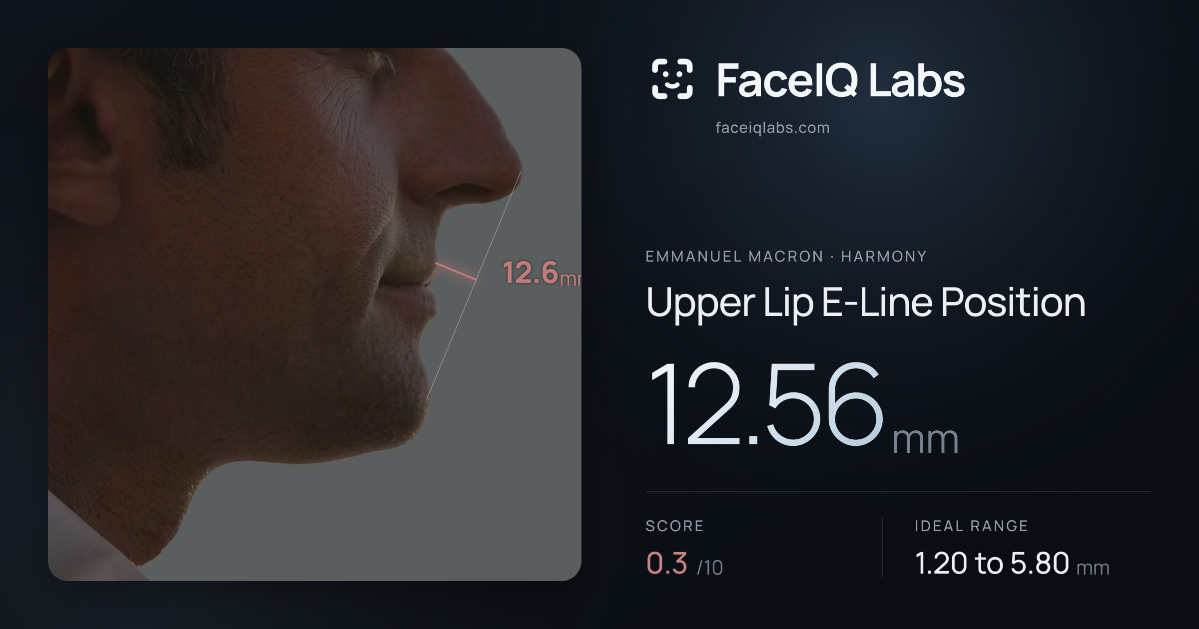 Emmanuel Macron Upper Lip E-Line Position: 12.56mm, drawn on the photo