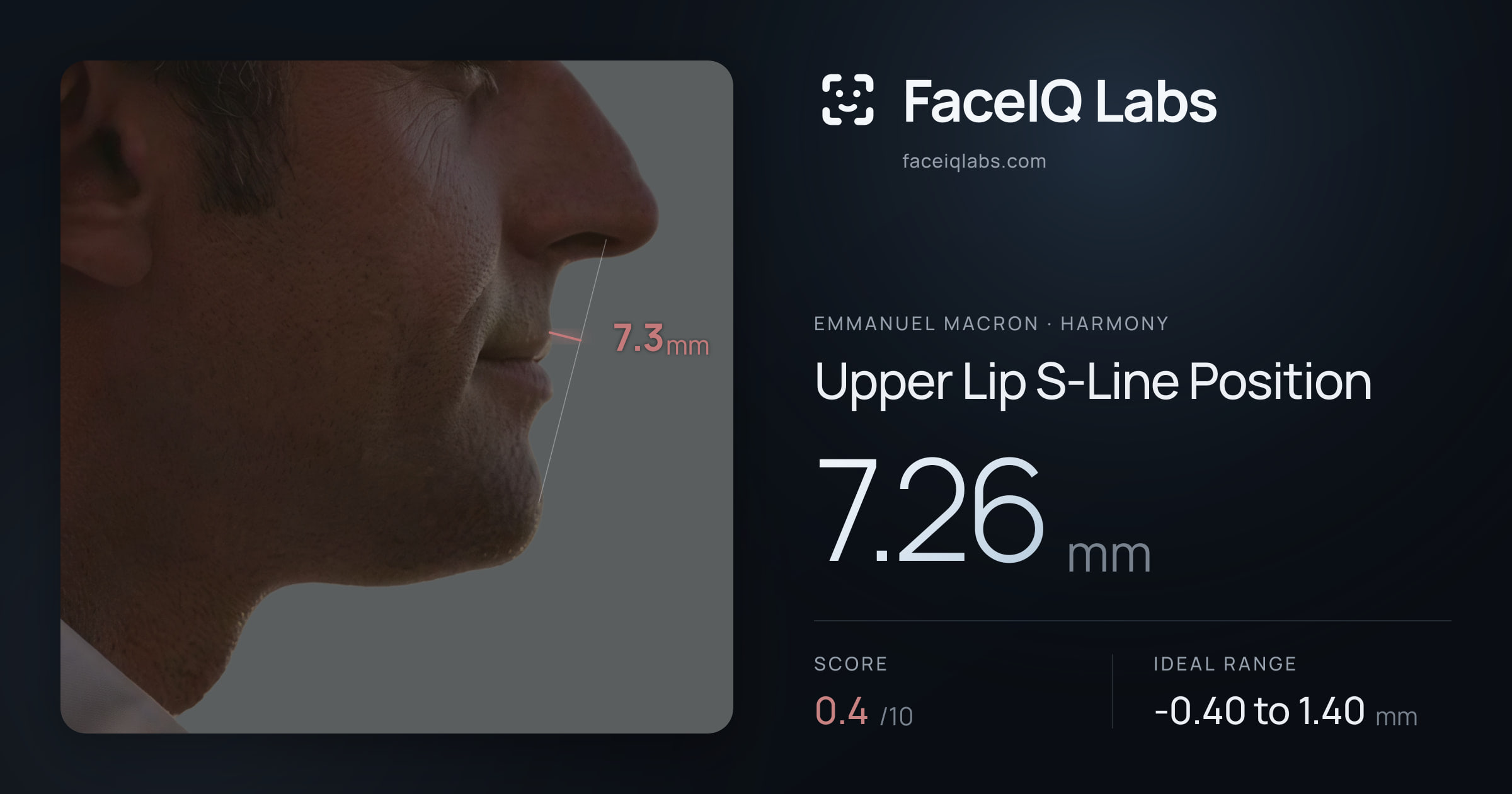 Emmanuel Macron Upper Lip S-Line Position: 7.26mm, drawn on the photo