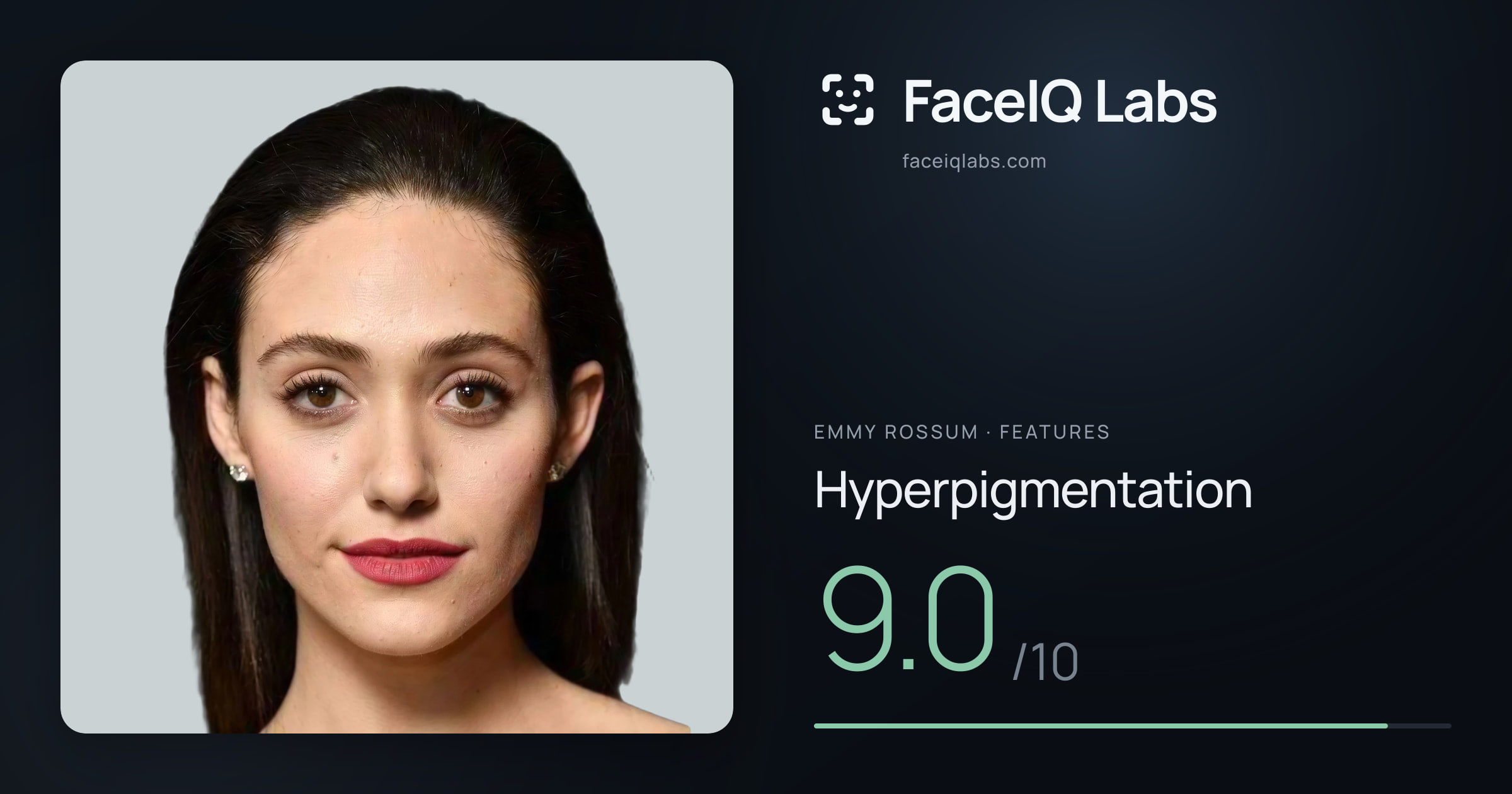 Emmy Rossum Hyperpigmentation: 9.0/10, drawn on the photo