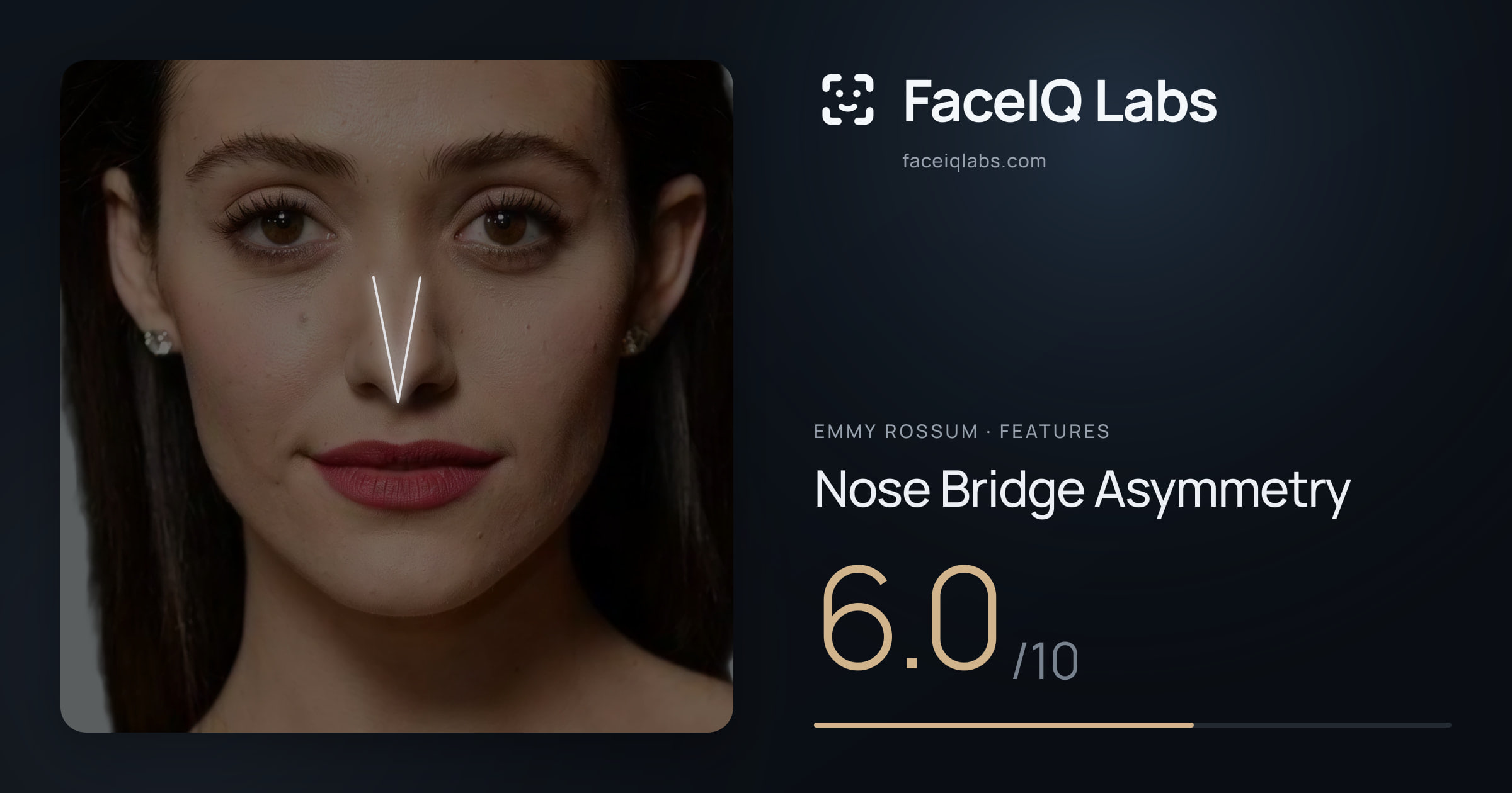 Emmy Rossum Nose Bridge Asymmetry: 6.0/10, drawn on the photo