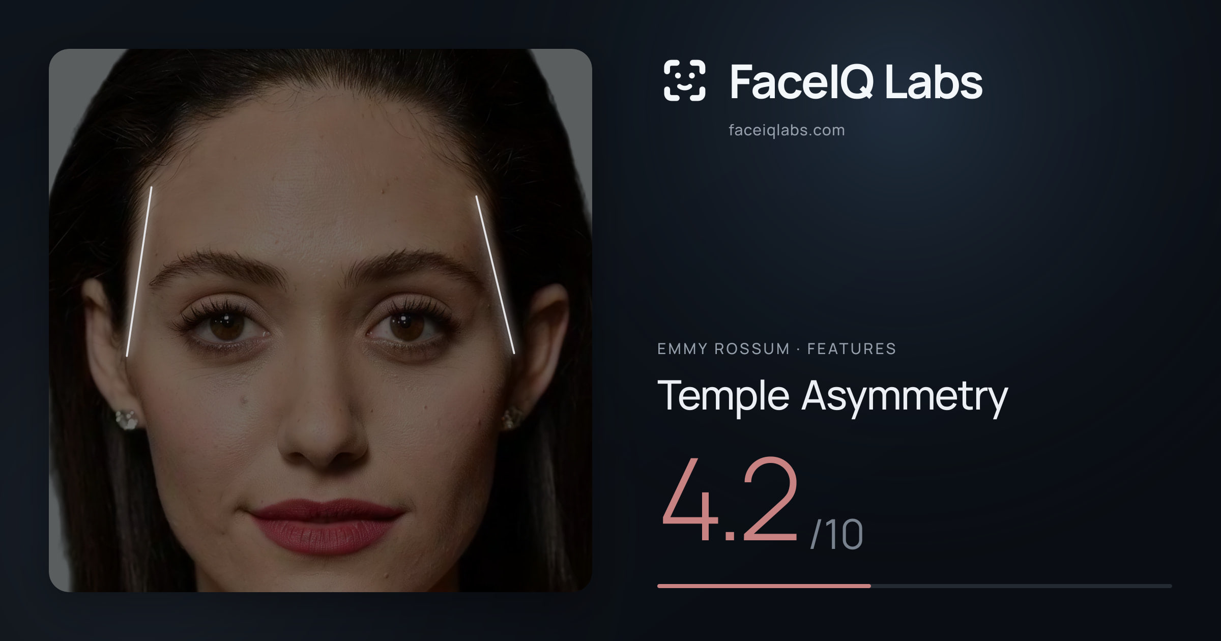 Emmy Rossum Temple Asymmetry: 4.2/10, drawn on the photo