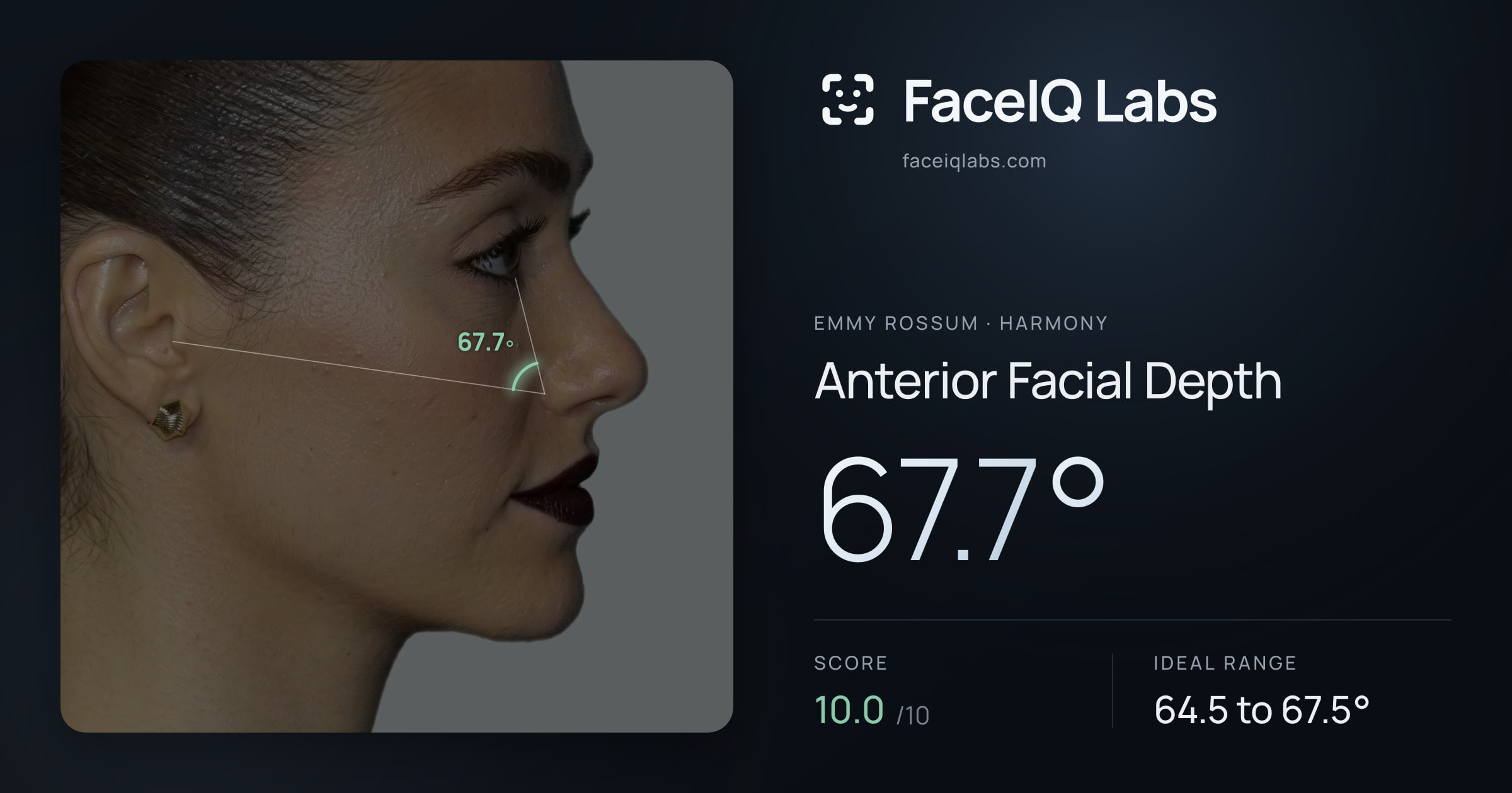 Emmy Rossum Anterior Facial Depth: 67.7°, drawn on the photo
