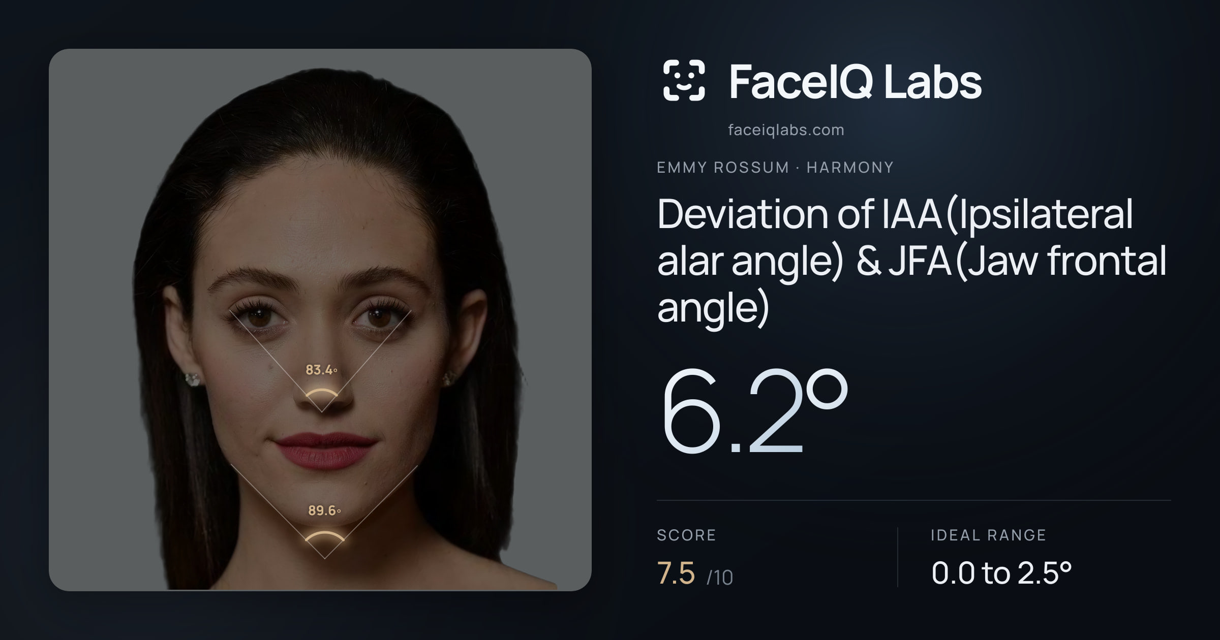 Emmy Rossum Deviation of IAA(Ipsilateral alar angle) & JFA(Jaw frontal angle): 6.2°, drawn on the photo