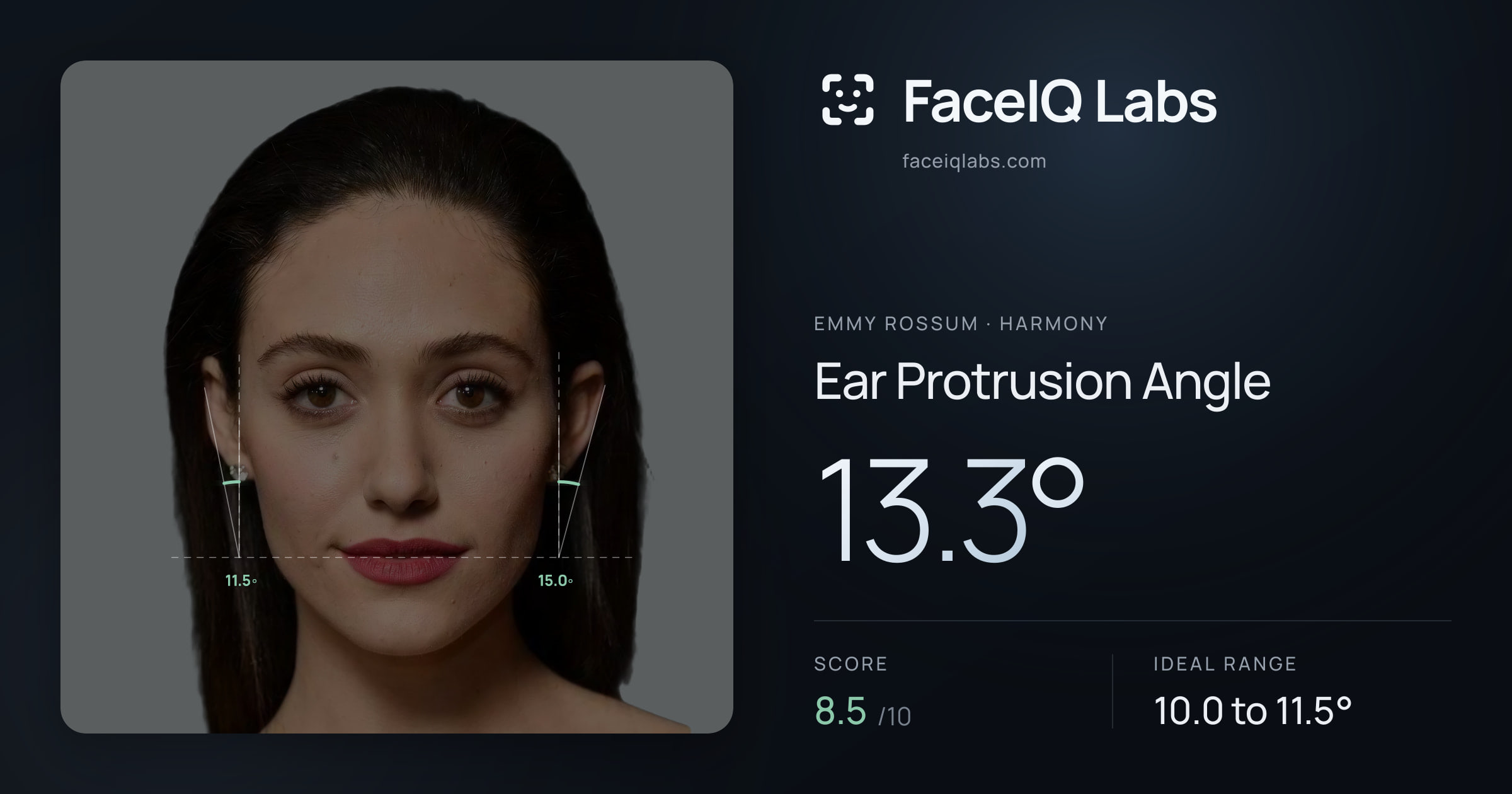 Emmy Rossum Ear Protrusion Angle: 13.3°, drawn on the photo
