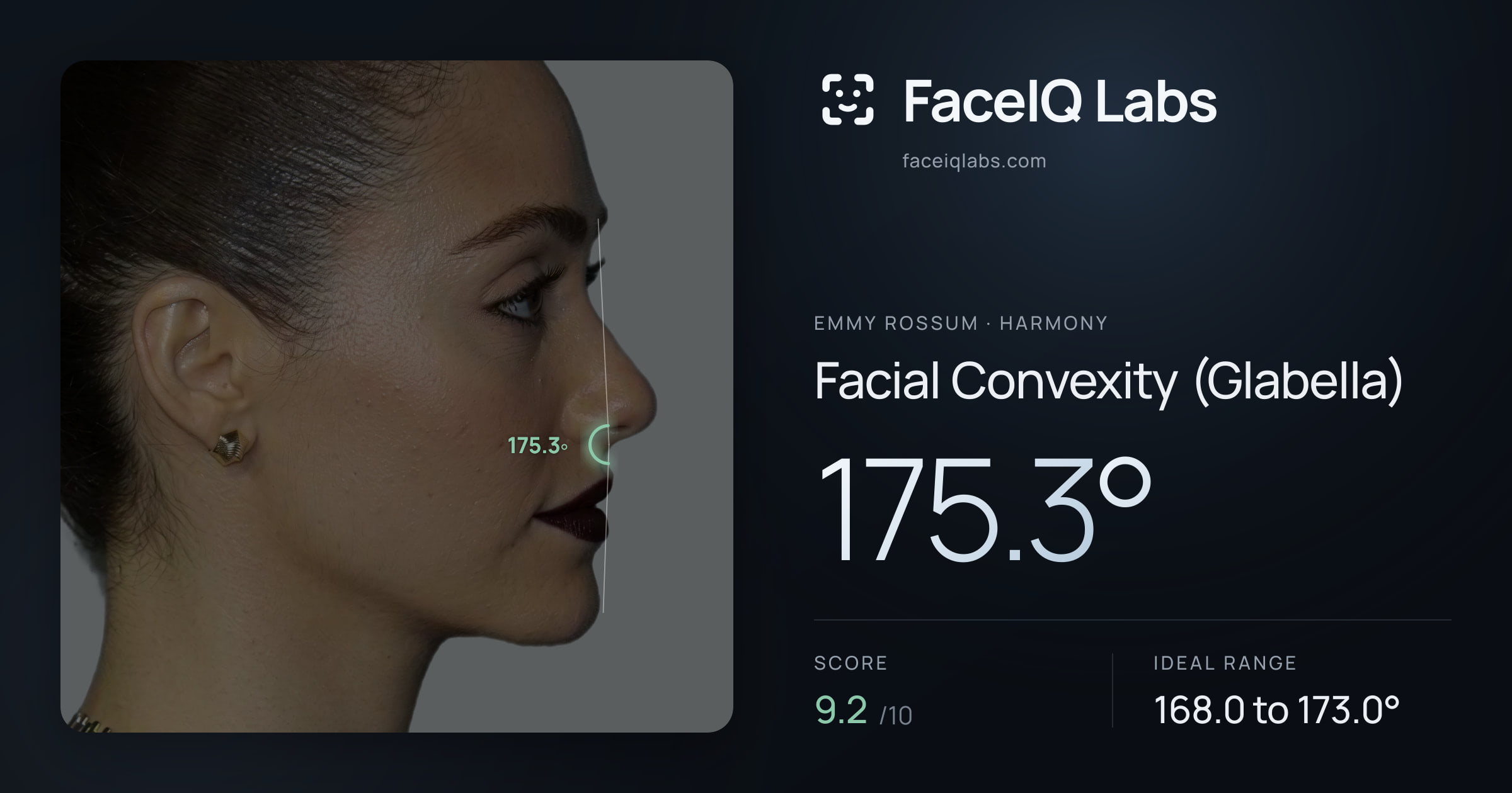 Emmy Rossum Facial Convexity (Glabella): 175.3°, drawn on the photo