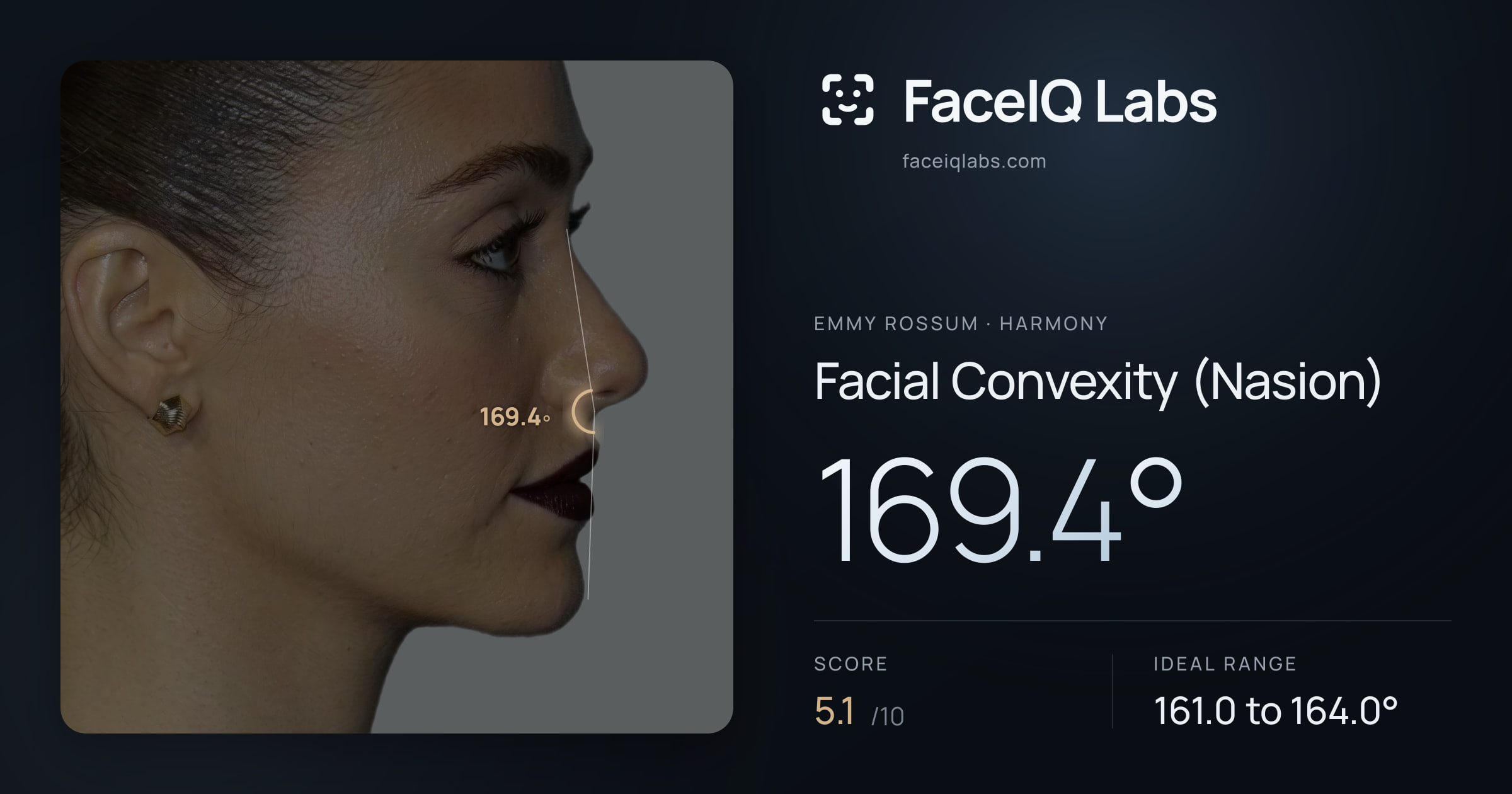 Emmy Rossum Facial Convexity (Nasion): 169.4°, drawn on the photo