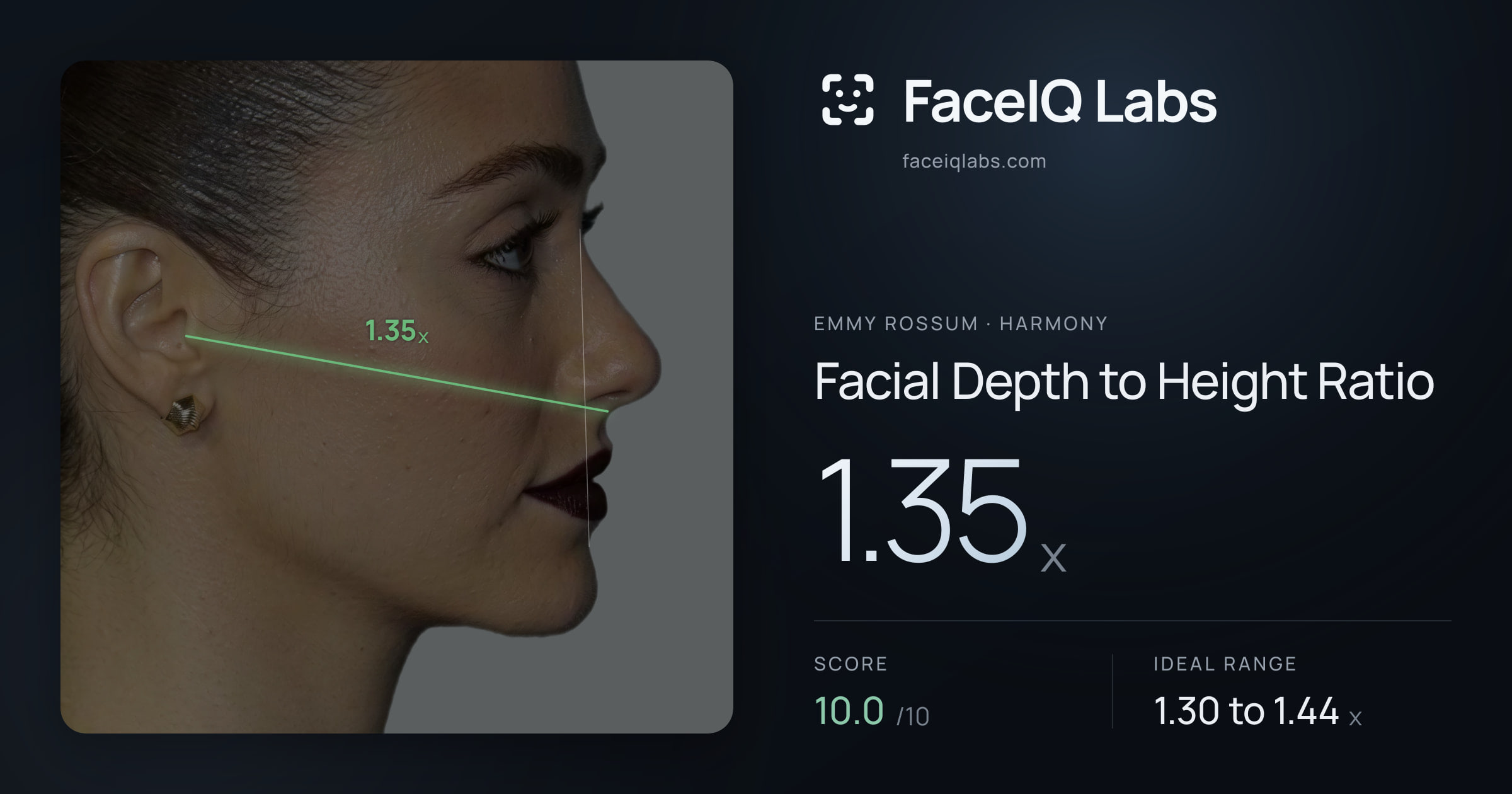 Emmy Rossum Facial Depth to Height Ratio: 1.35x, drawn on the photo