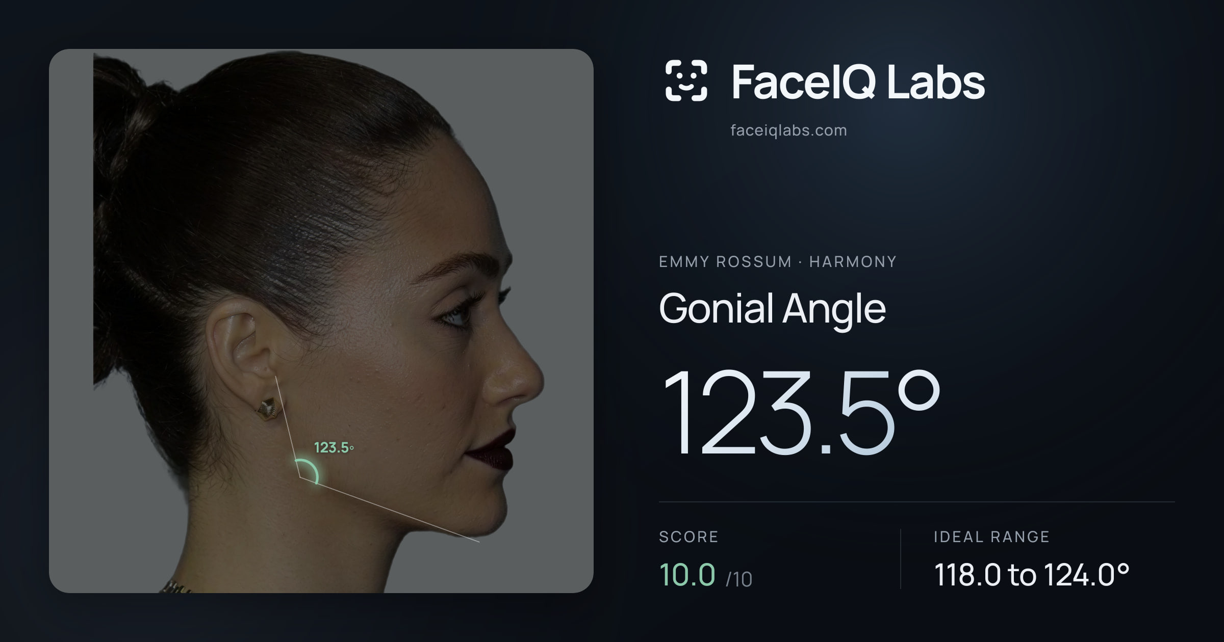 Emmy Rossum Gonial Angle: 123.5°, drawn on the photo