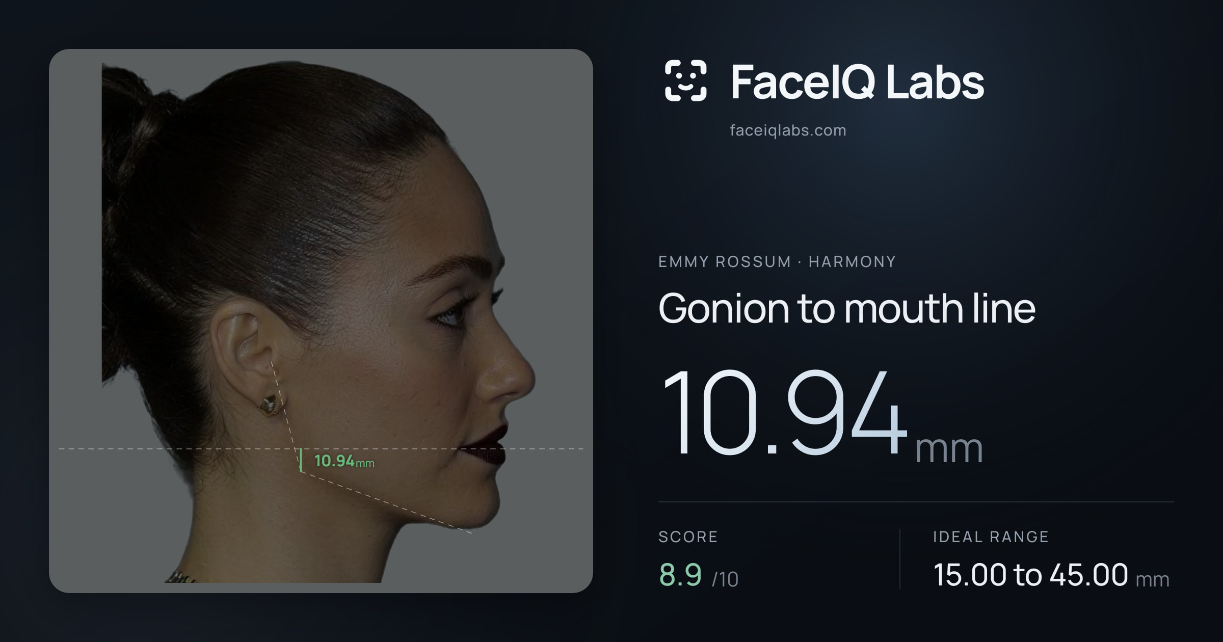 Emmy Rossum Gonion to mouth line: 10.94mm, drawn on the photo