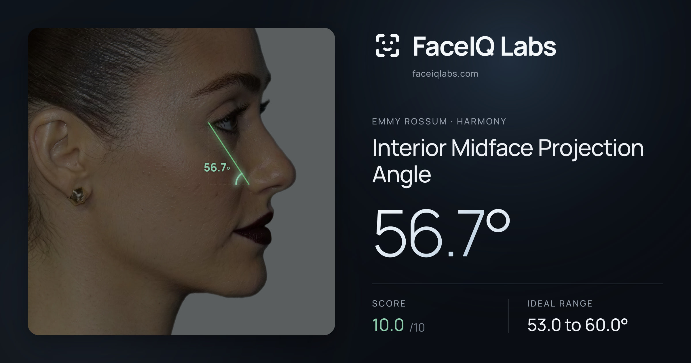 Emmy Rossum Interior Midface Projection Angle: 56.7°, drawn on the photo