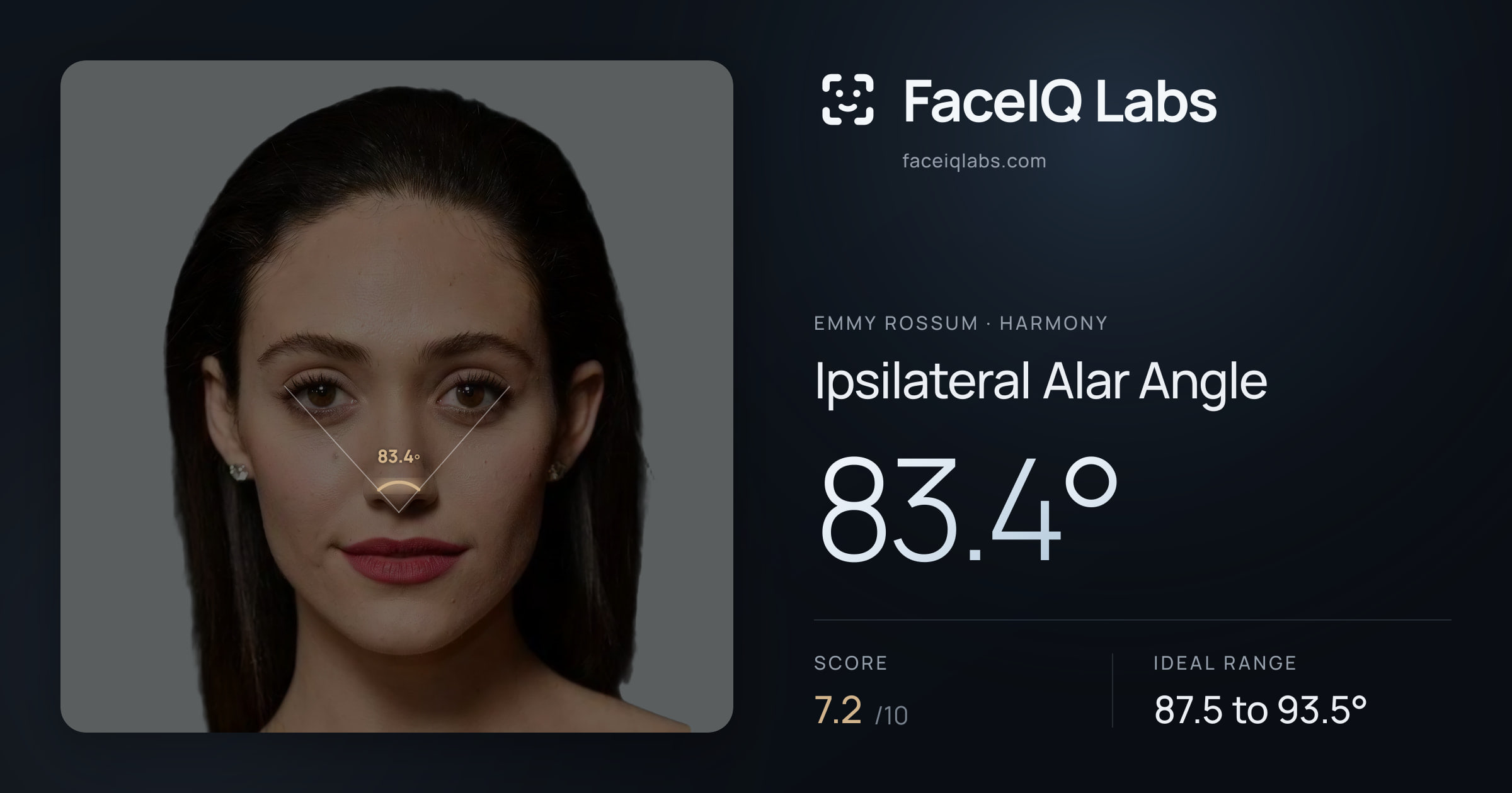 Emmy Rossum Ipsilateral Alar Angle: 83.4°, drawn on the photo