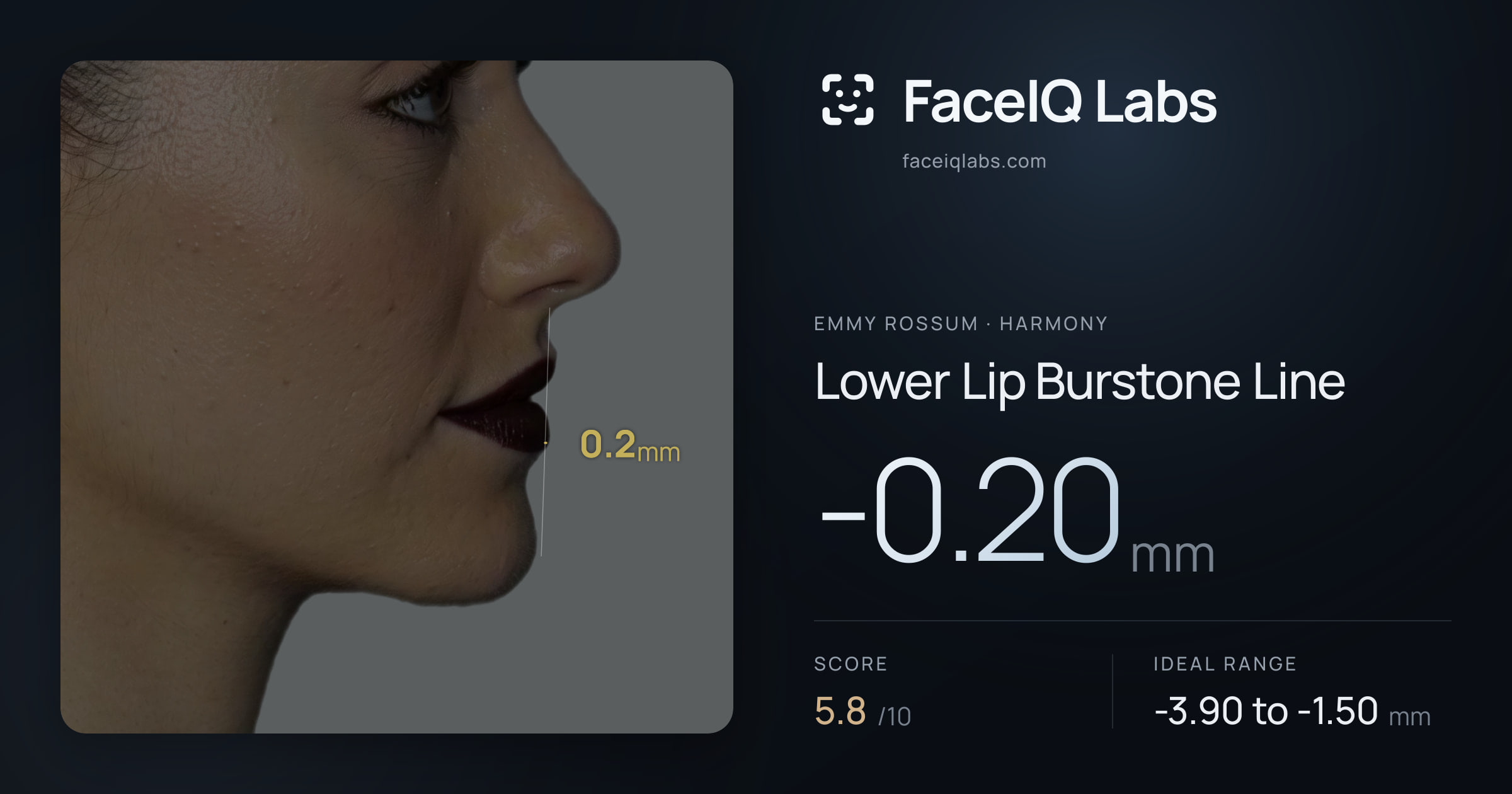 Emmy Rossum Lower Lip Burstone Line: -0.20mm, drawn on the photo