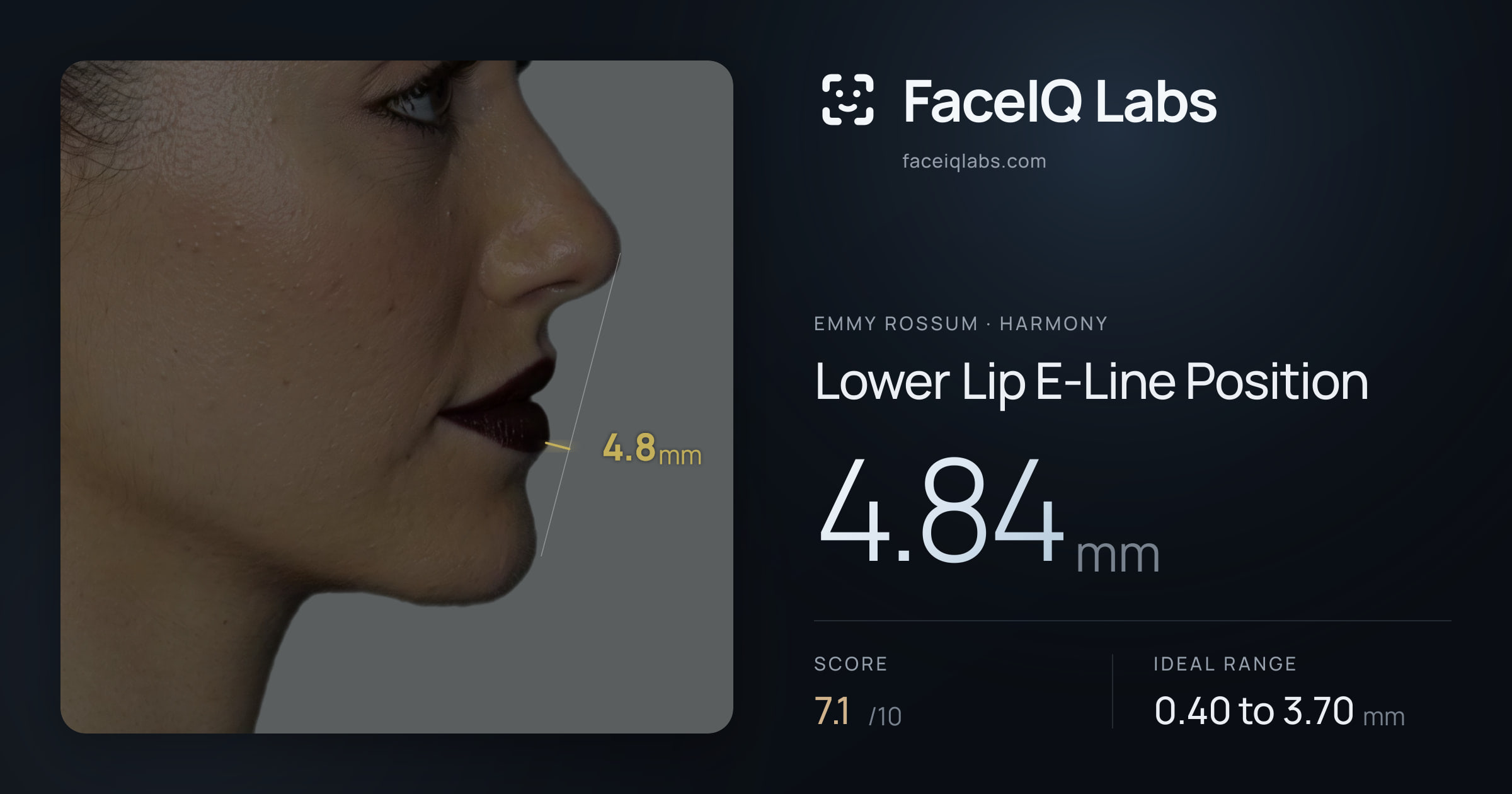 Emmy Rossum Lower Lip E-Line Position: 4.84mm, drawn on the photo