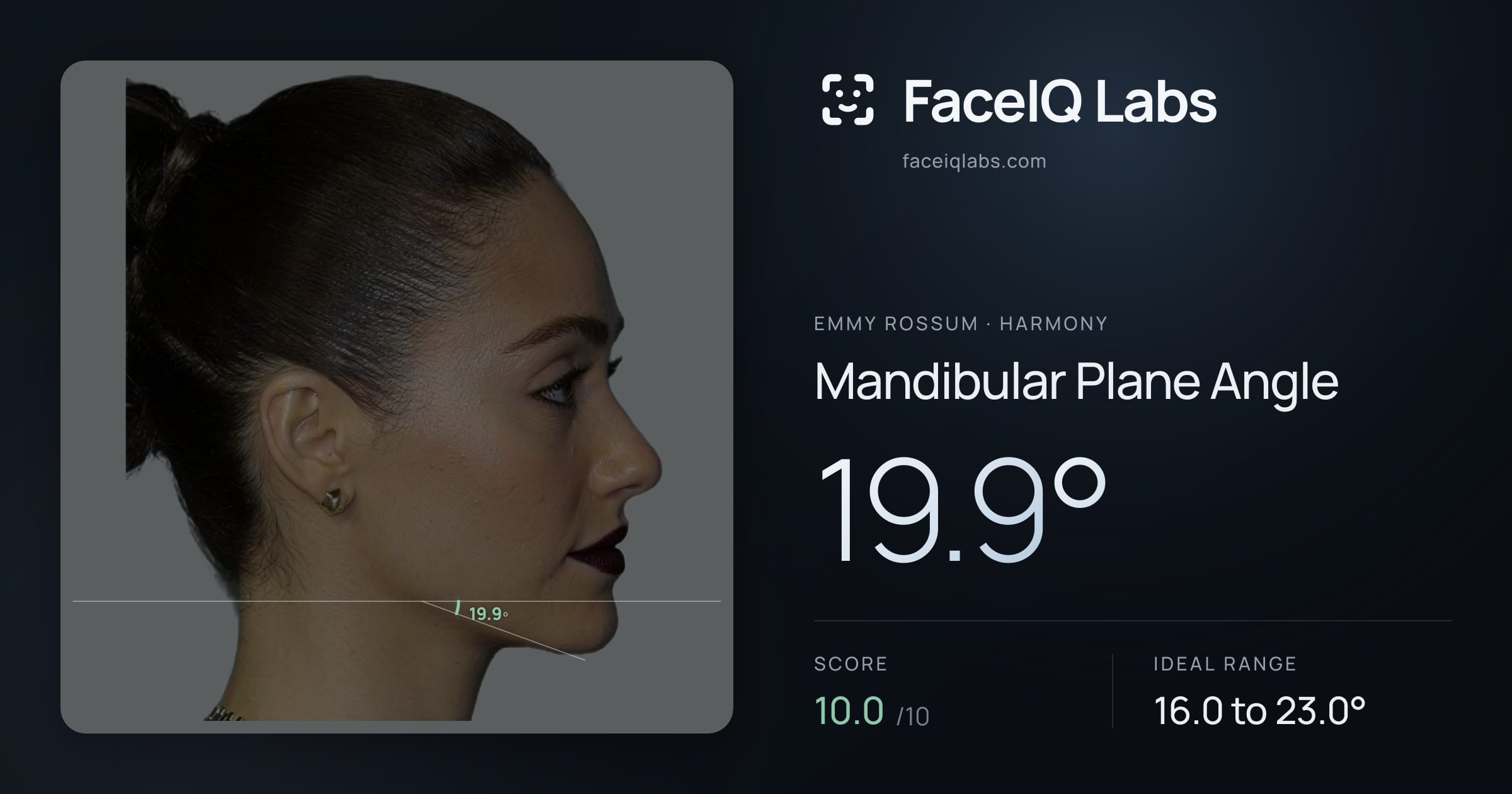 Emmy Rossum Mandibular Plane Angle: 19.9°, drawn on the photo