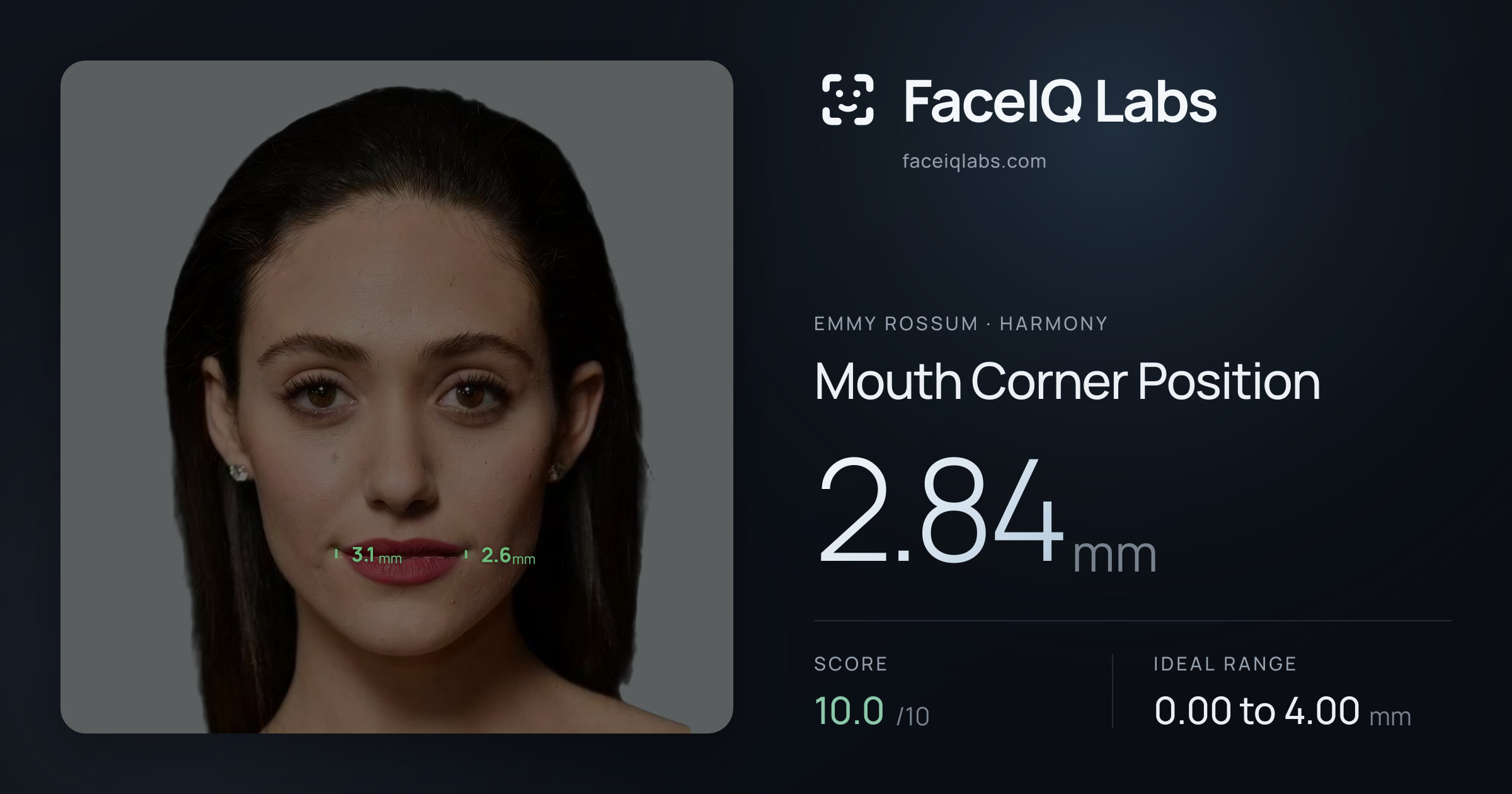 Emmy Rossum Mouth Corner Position: 2.84mm, drawn on the photo