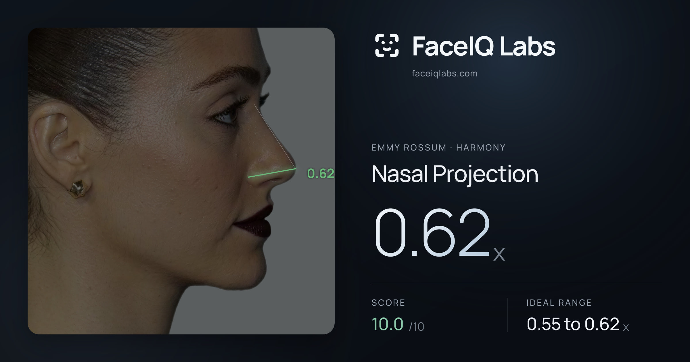 Emmy Rossum Nasal Projection: 0.62x, drawn on the photo
