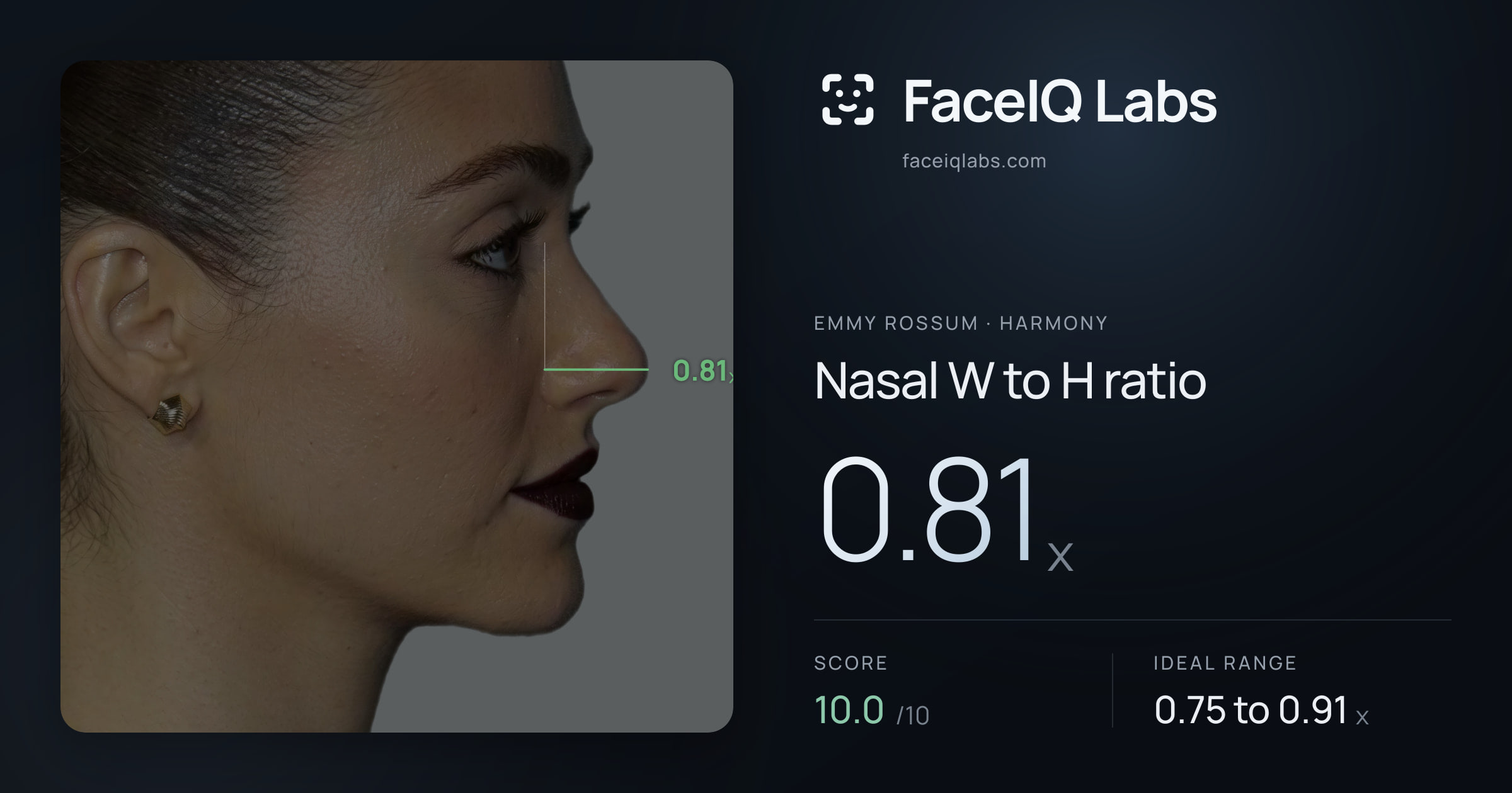 Emmy Rossum Nasal W to H ratio: 0.81x, drawn on the photo