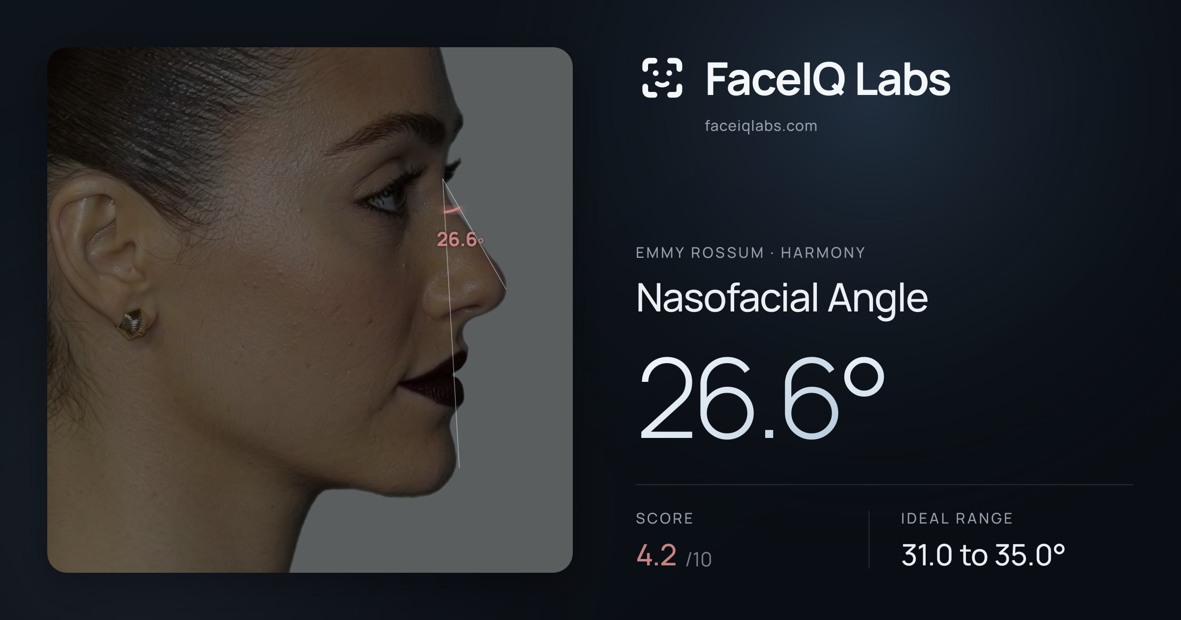 Emmy Rossum Nasofacial Angle: 26.6°, drawn on the photo
