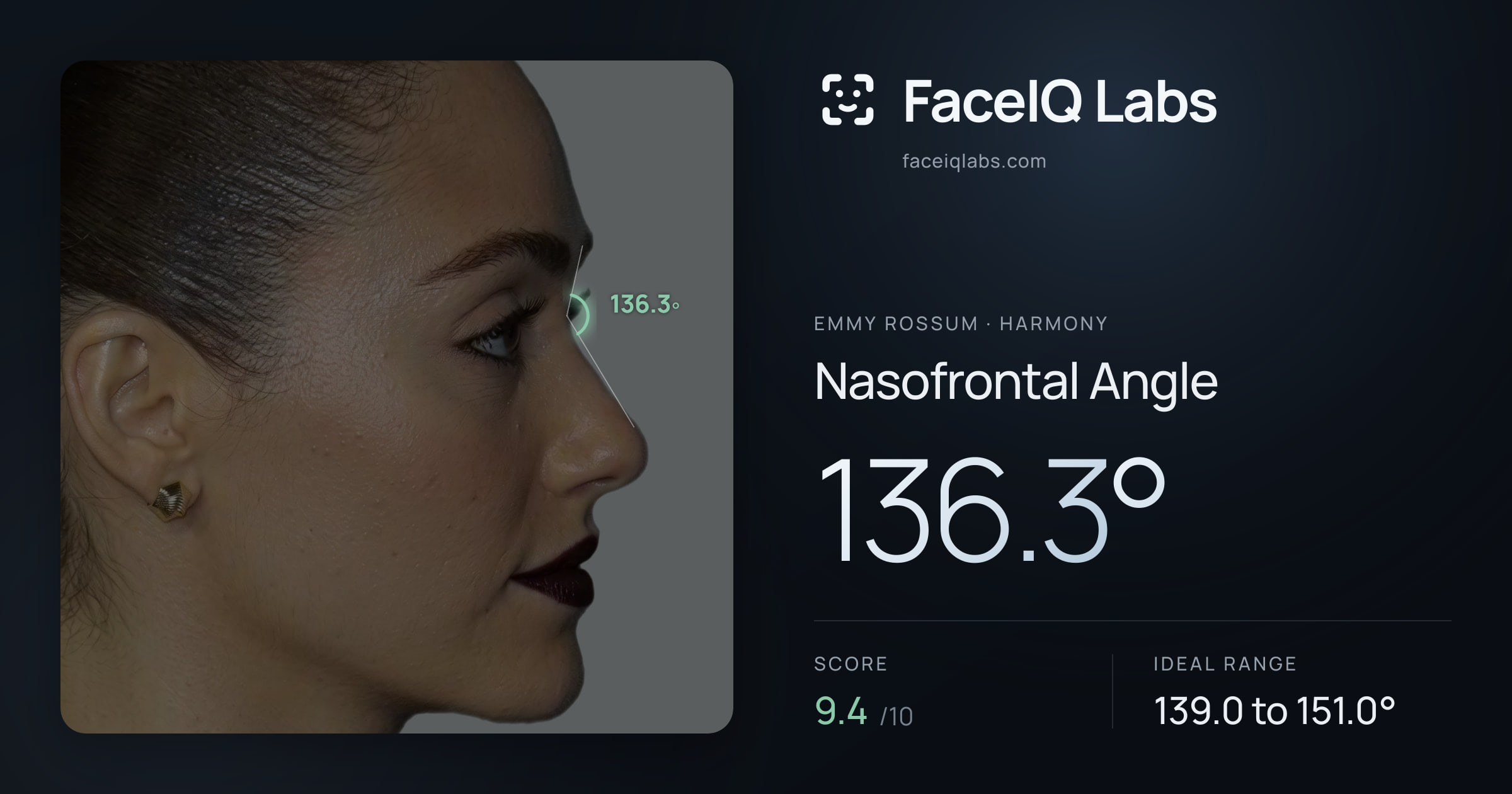Emmy Rossum Nasofrontal Angle: 136.3°, drawn on the photo