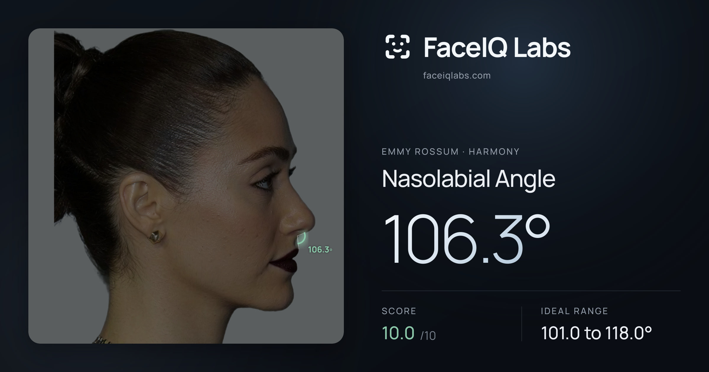 Emmy Rossum Nasolabial Angle: 106.3°, drawn on the photo