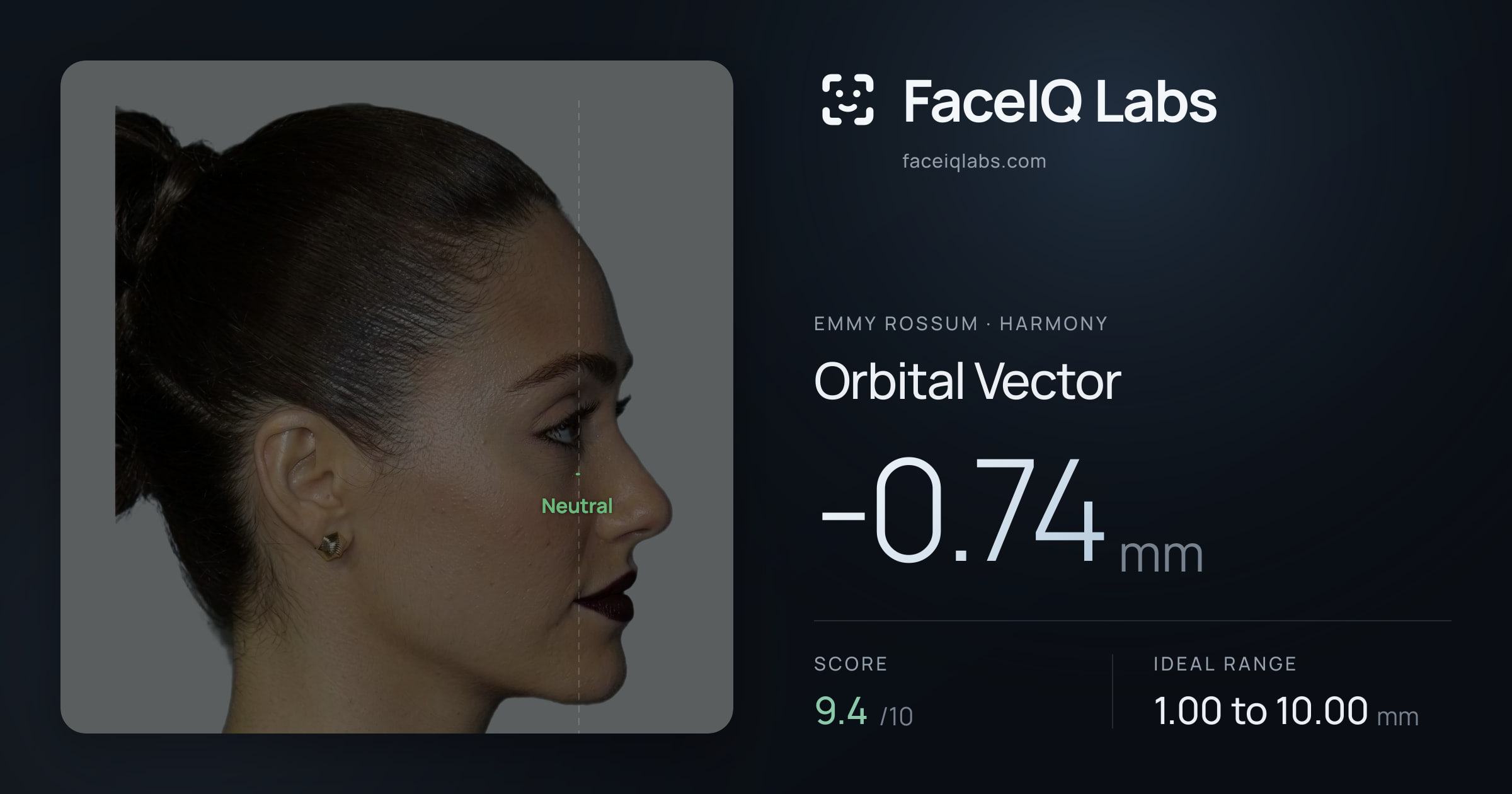 Emmy Rossum Orbital Vector: -0.74mm, drawn on the photo