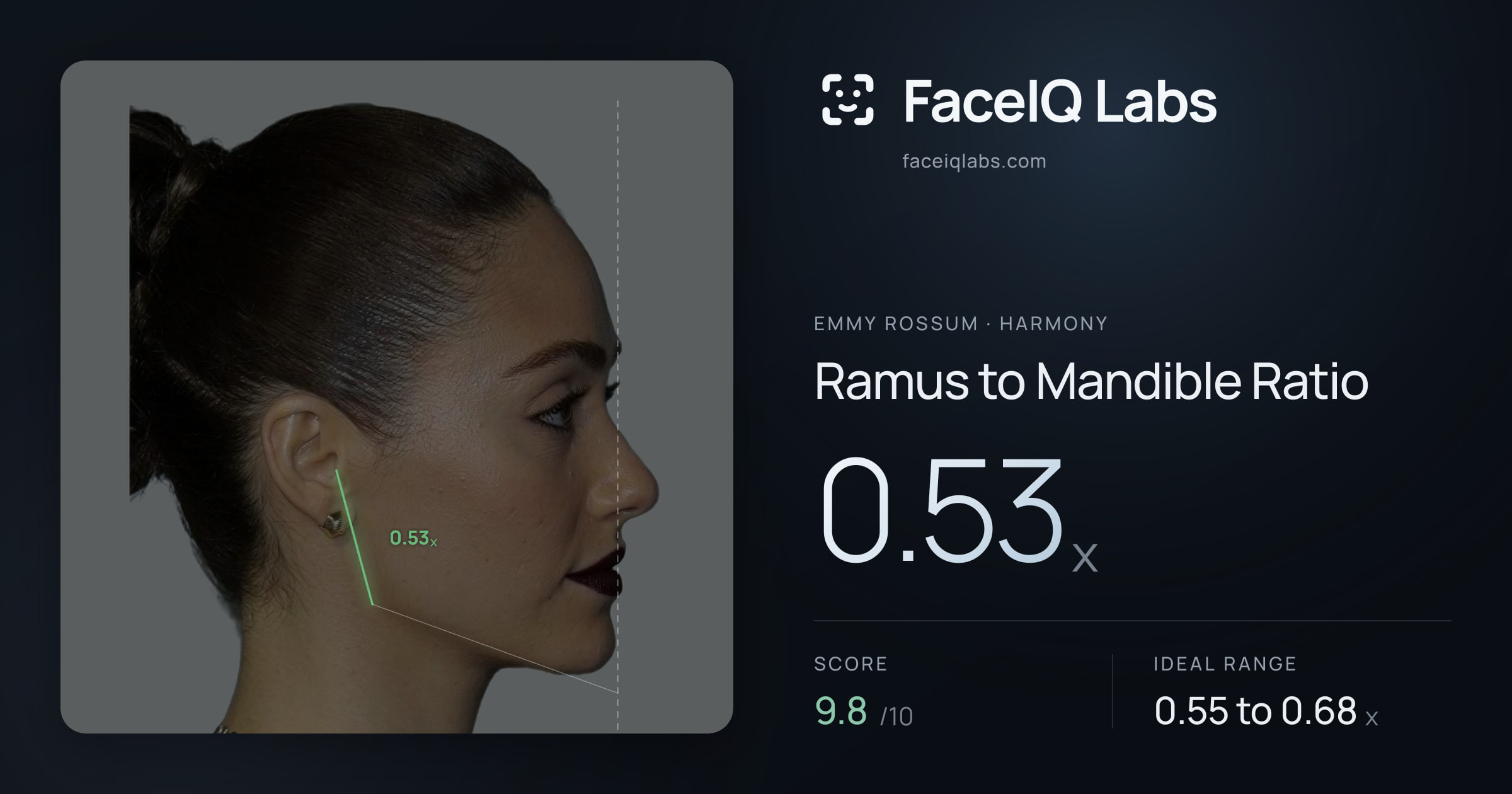 Emmy Rossum Ramus to Mandible Ratio: 0.53x, drawn on the photo