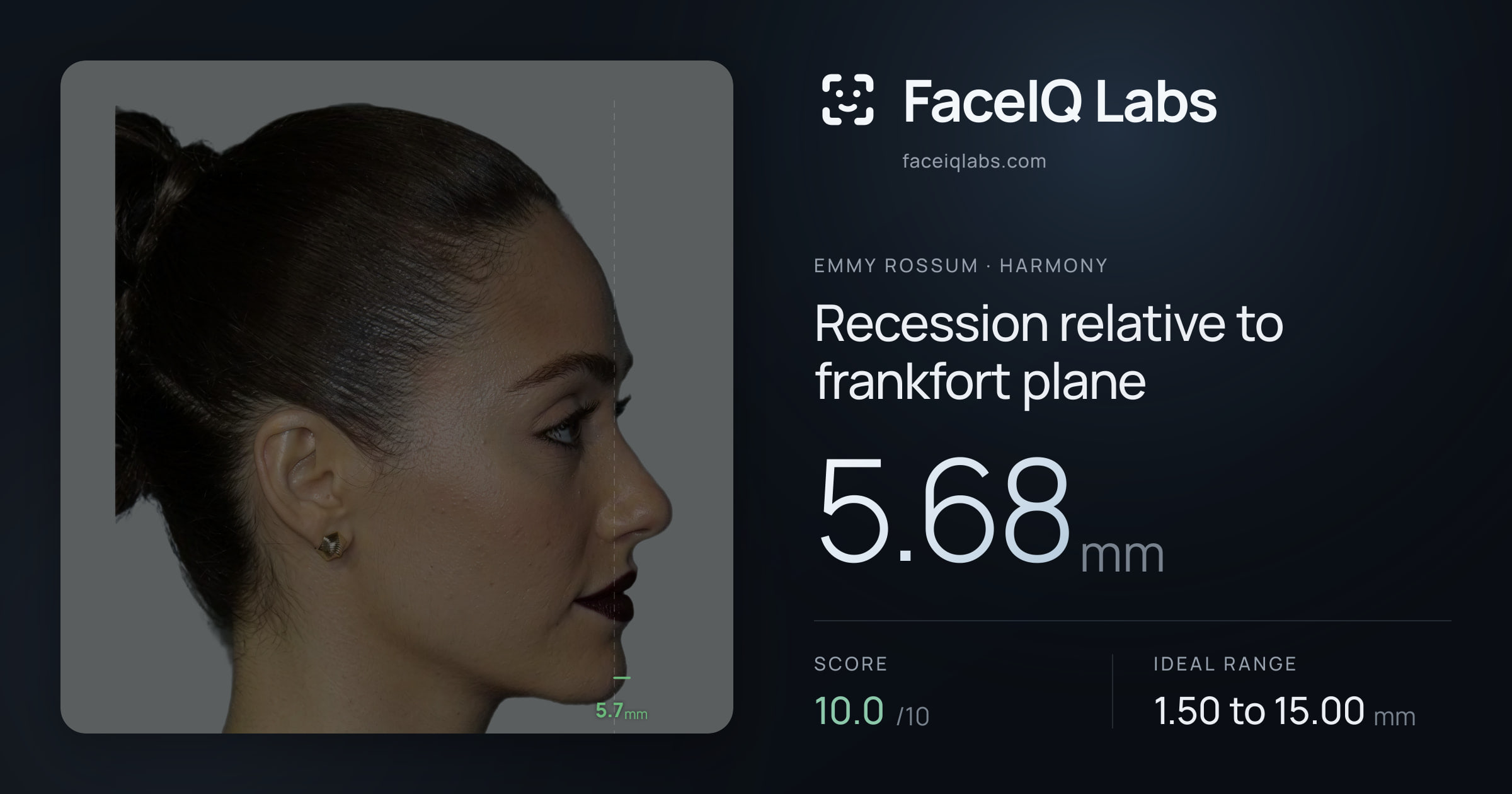 Emmy Rossum Recession relative to frankfort plane: 5.68mm, drawn on the photo