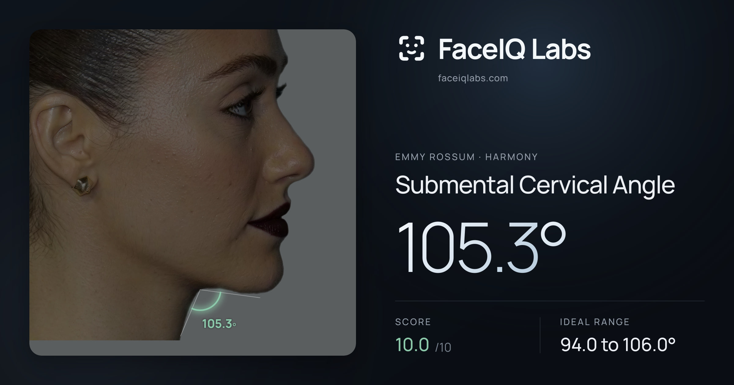 Emmy Rossum Submental Cervical Angle: 105.3°, drawn on the photo