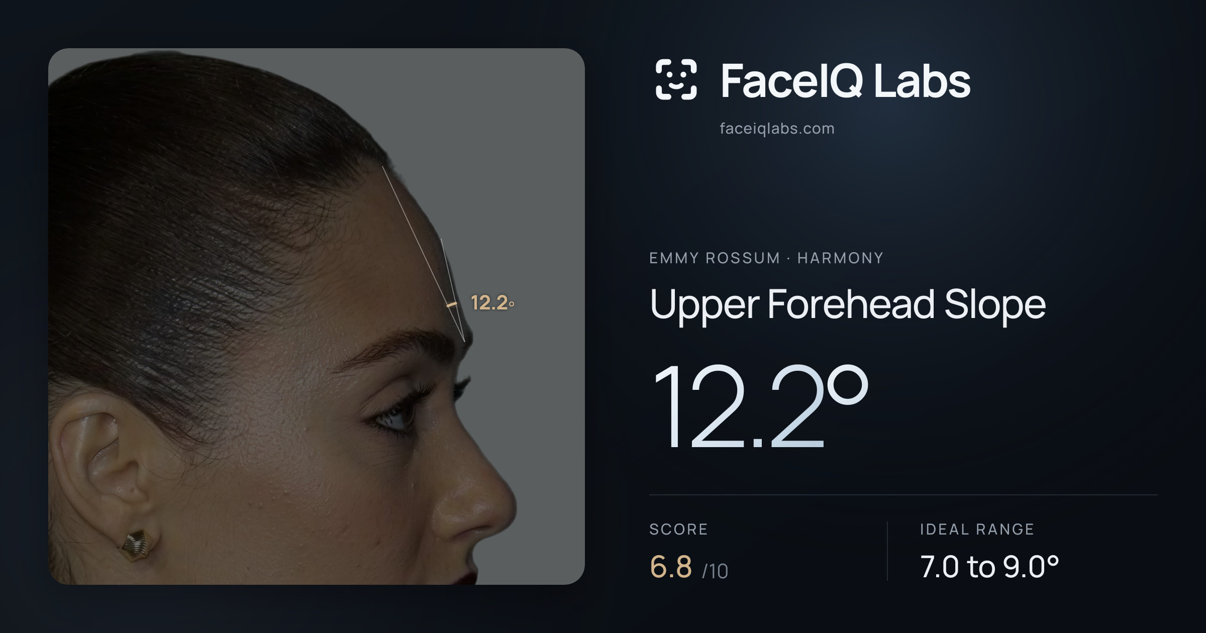 Emmy Rossum Upper Forehead Slope: 12.2°, drawn on the photo