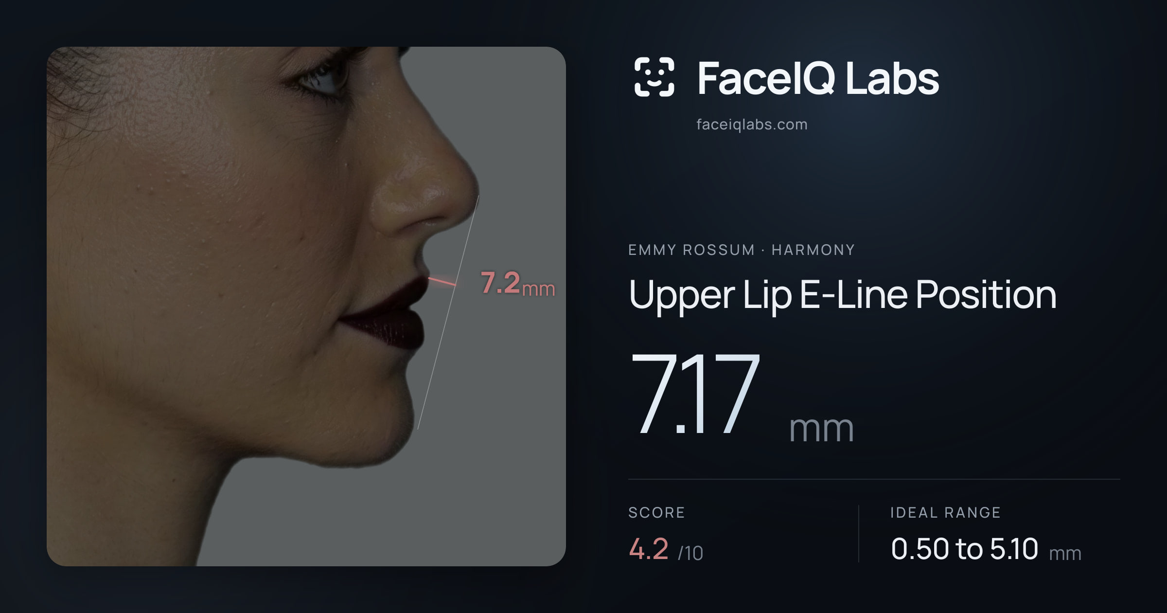 Emmy Rossum Upper Lip E-Line Position: 7.17mm, drawn on the photo