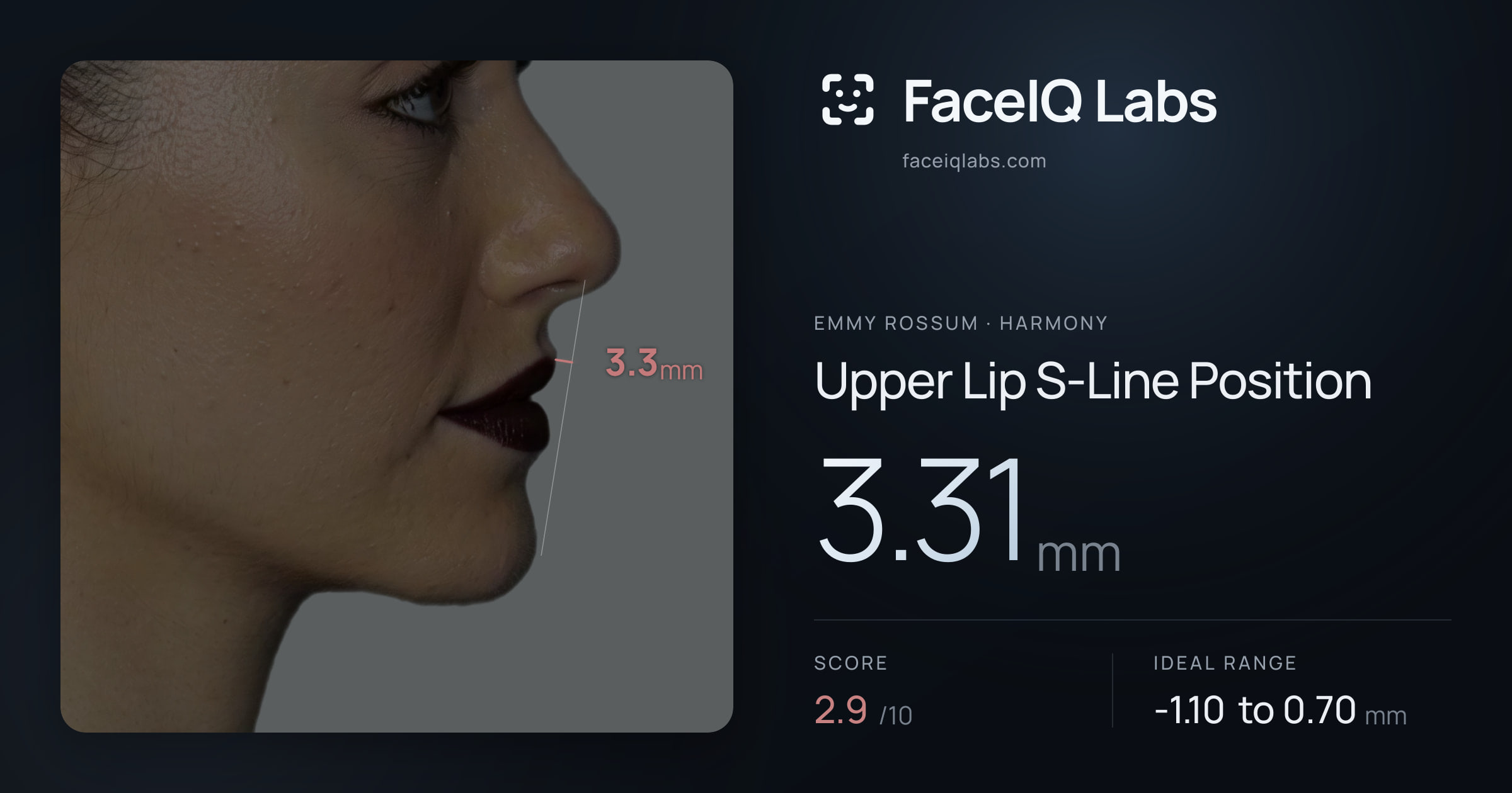Emmy Rossum Upper Lip S-Line Position: 3.31mm, drawn on the photo