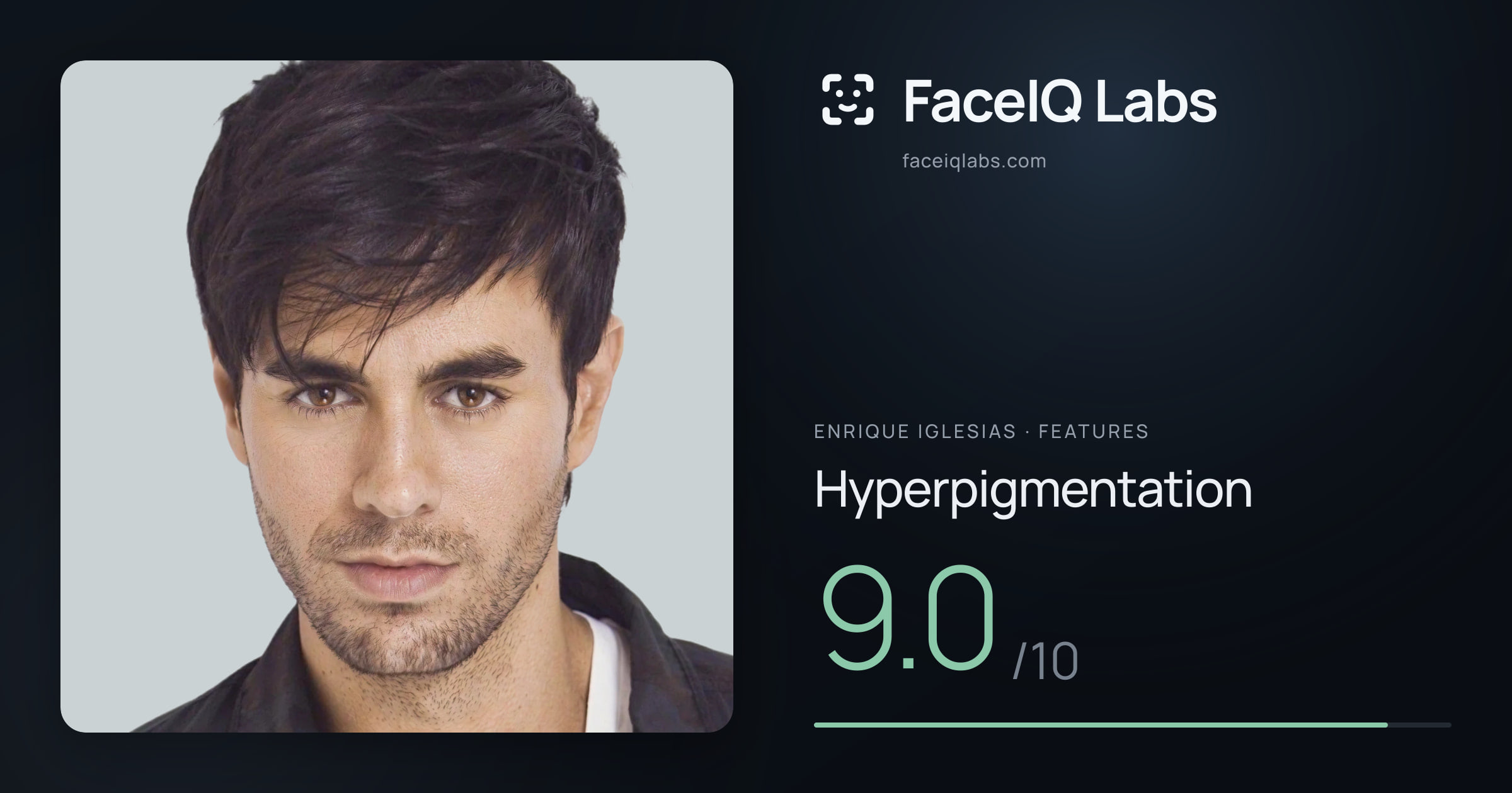 Enrique Iglesias Hyperpigmentation: 9.0/10, drawn on the photo