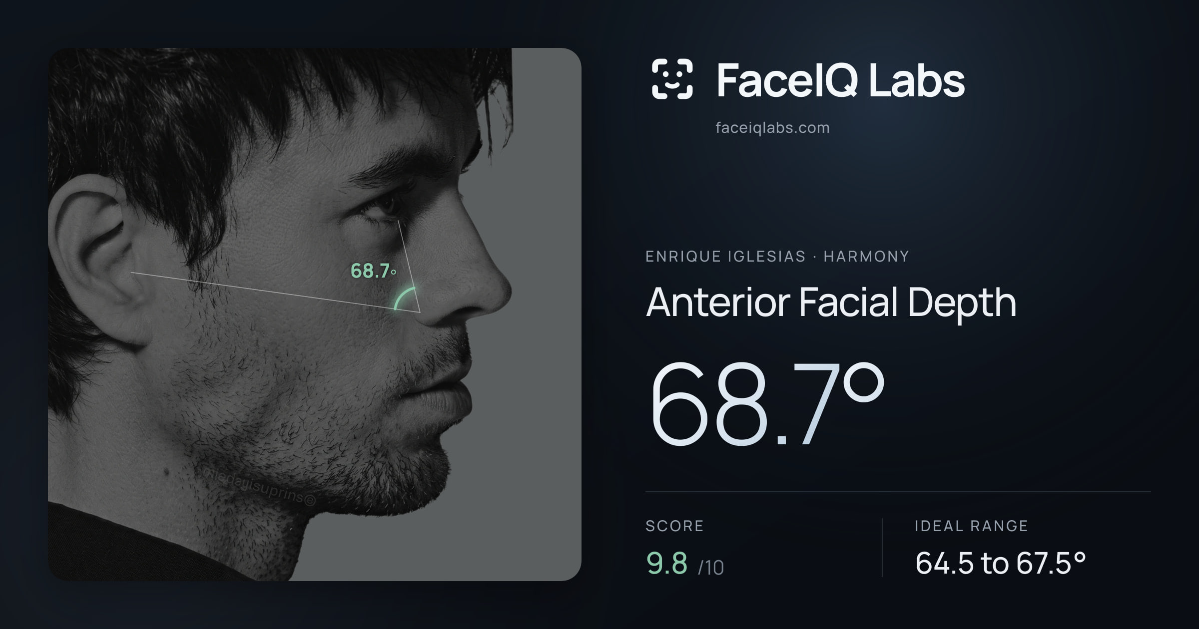 Enrique Iglesias Anterior Facial Depth: 68.7°, drawn on the photo
