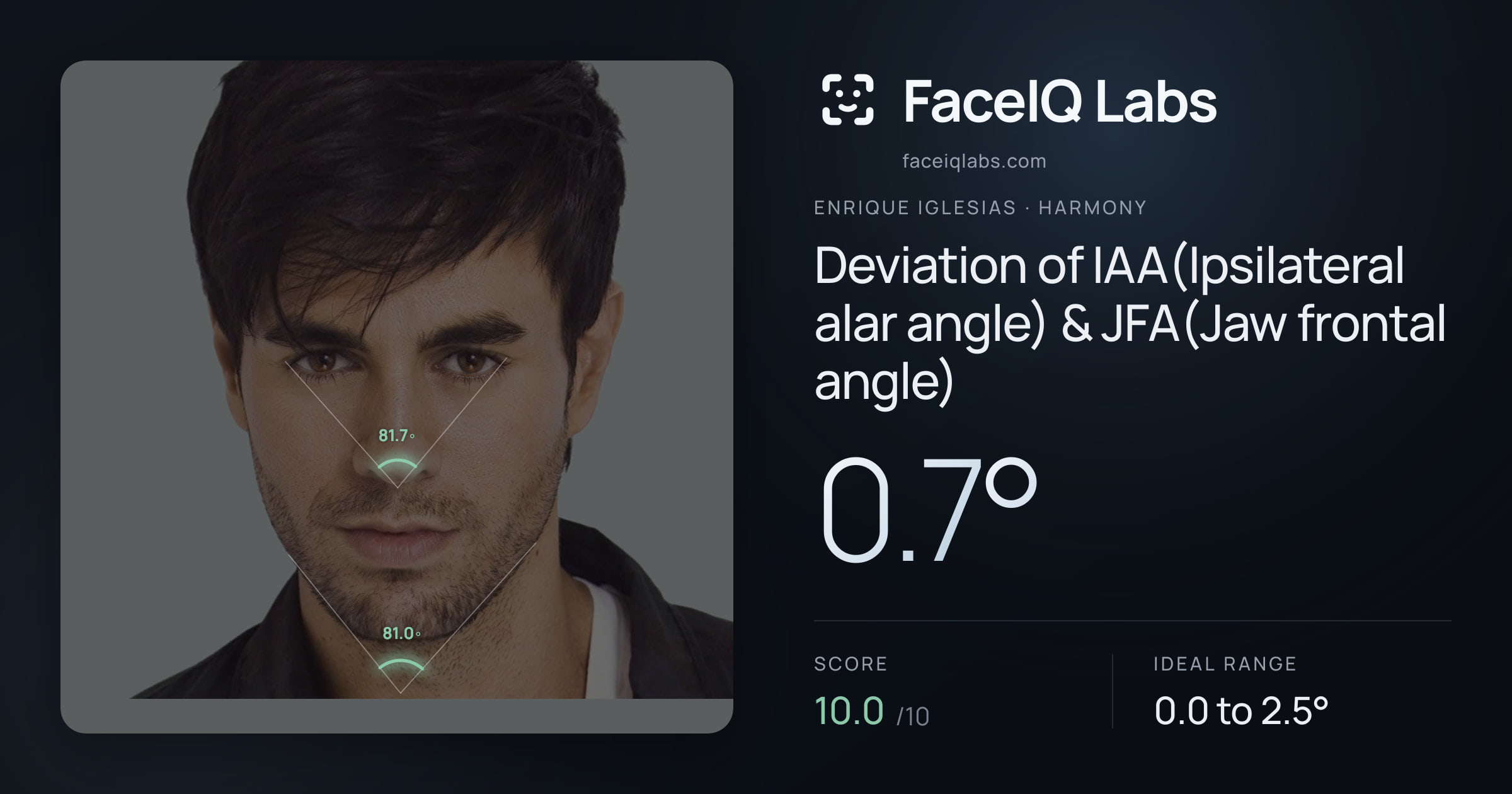 Enrique Iglesias Deviation of IAA(Ipsilateral alar angle) & JFA(Jaw frontal angle): 0.7°, drawn on the photo