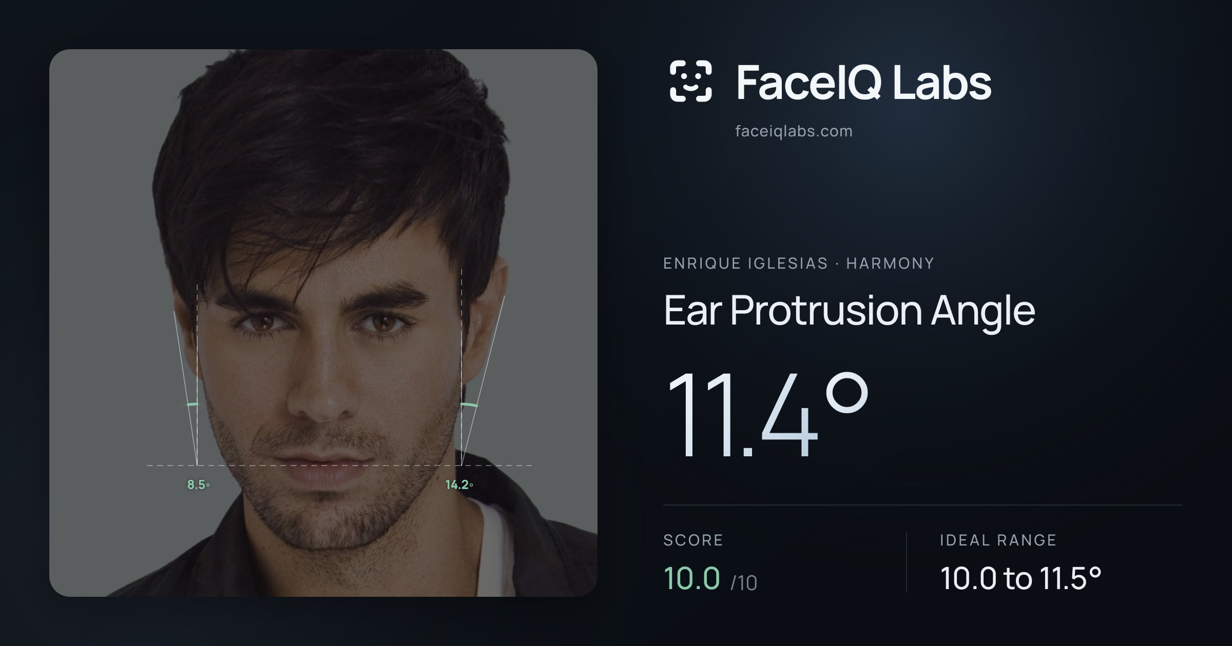Enrique Iglesias Ear Protrusion Angle: 11.4°, drawn on the photo