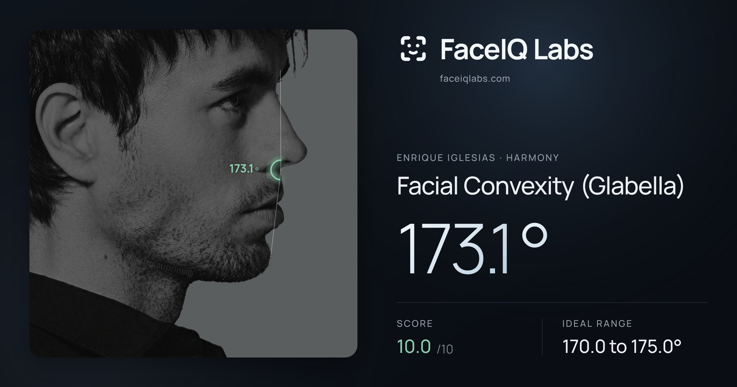 Enrique Iglesias Facial Convexity (Glabella): 173.1°, drawn on the photo