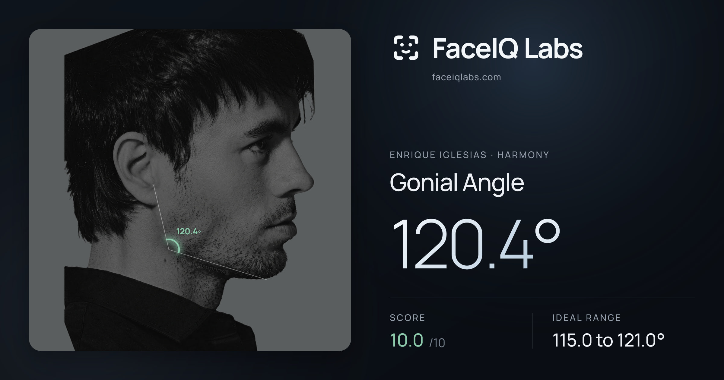 Enrique Iglesias Gonial Angle: 120.4°, drawn on the photo
