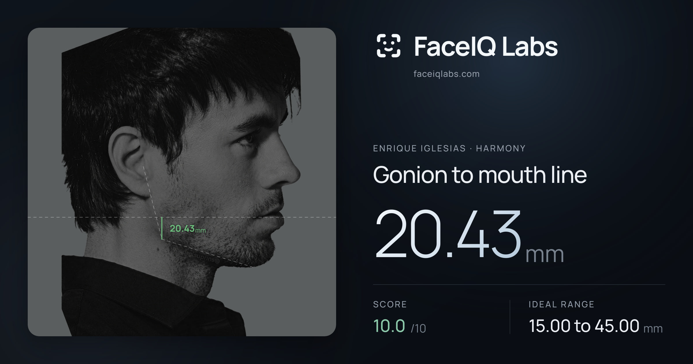 Enrique Iglesias Gonion to mouth line: 20.43mm, drawn on the photo