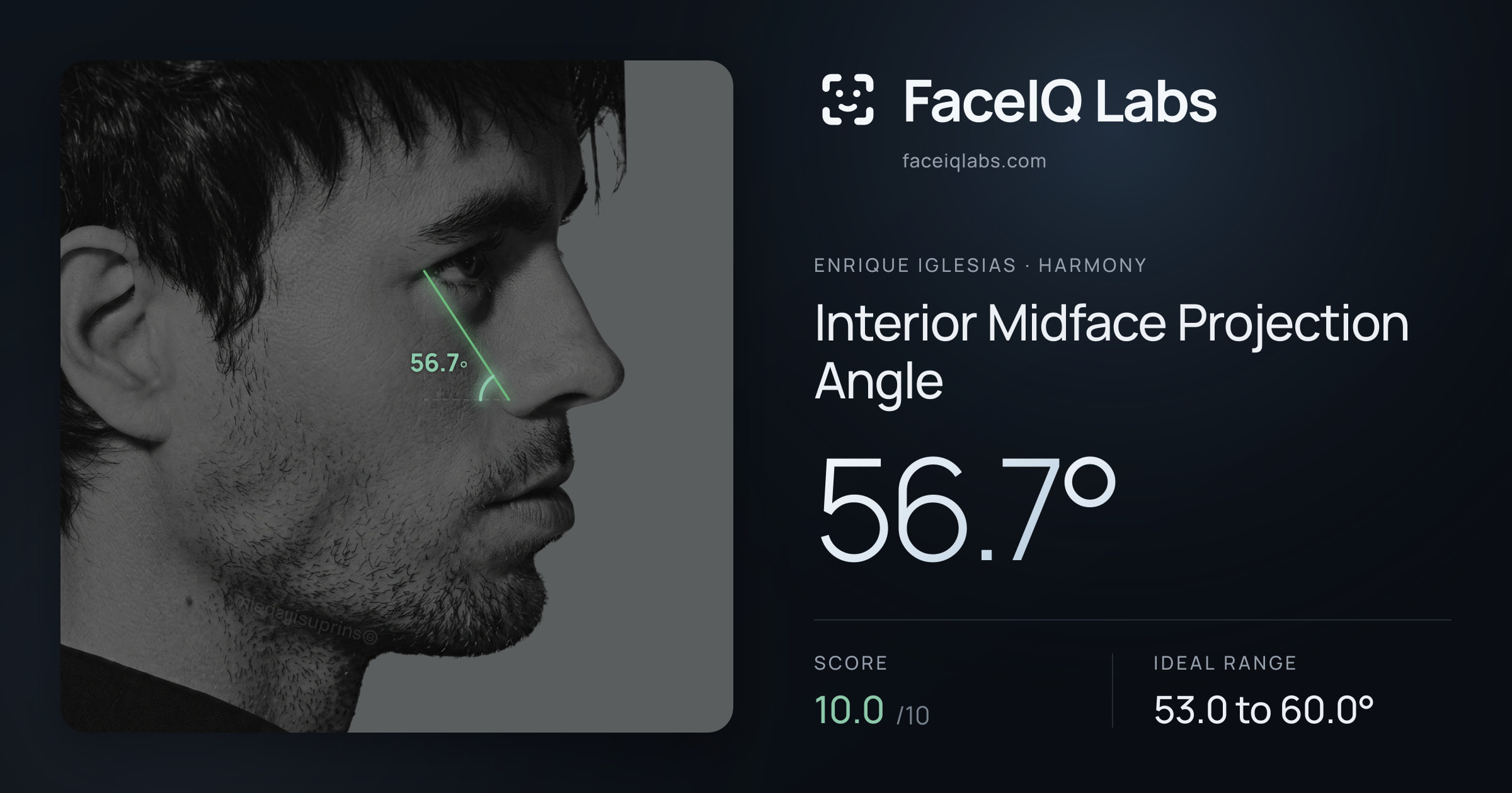 Enrique Iglesias Interior Midface Projection Angle: 56.7°, drawn on the photo