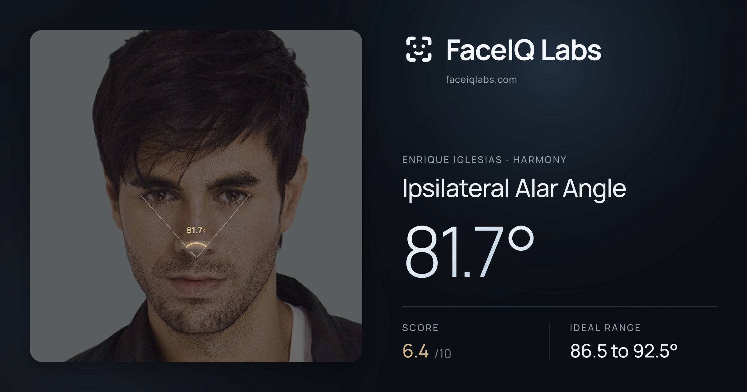 Enrique Iglesias Ipsilateral Alar Angle: 81.7°, drawn on the photo