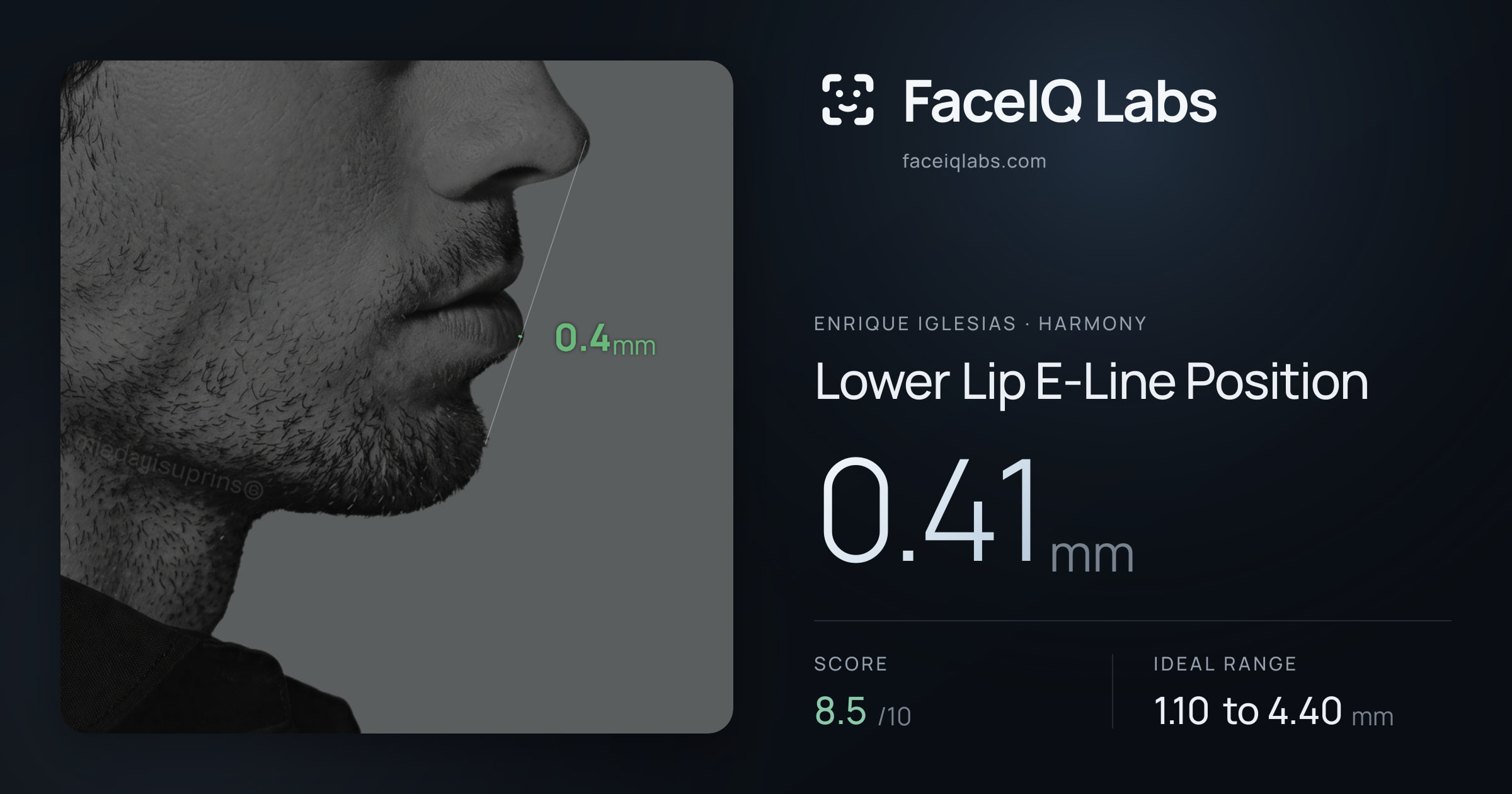 Enrique Iglesias Lower Lip E-Line Position: 0.41mm, drawn on the photo