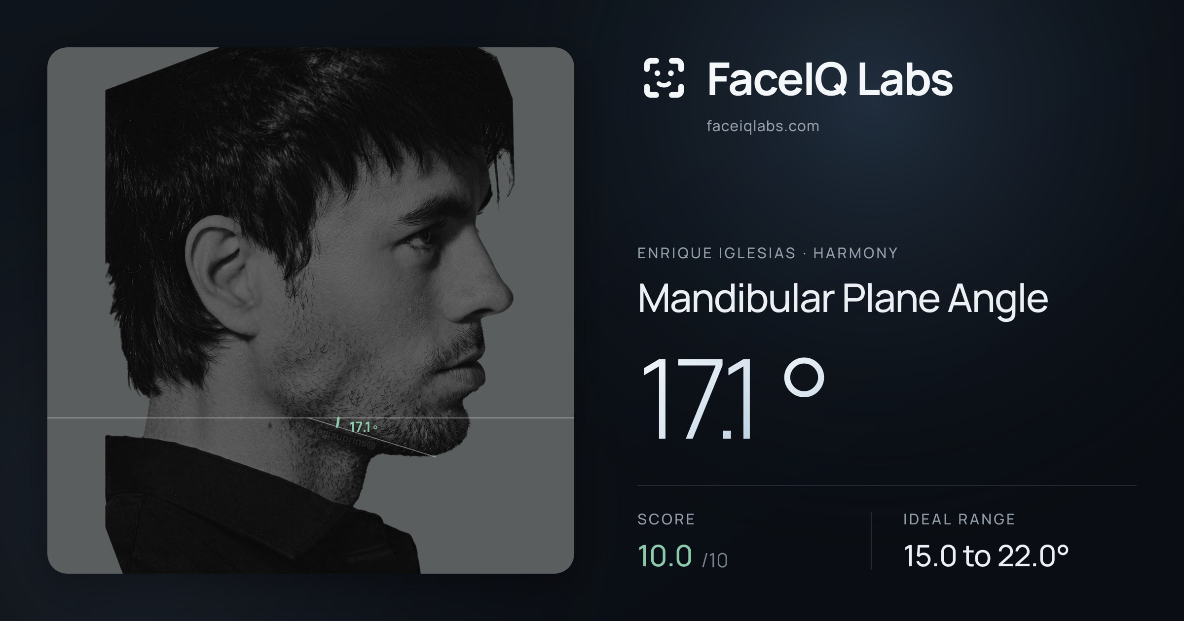 Enrique Iglesias Mandibular Plane Angle: 17.1°, drawn on the photo