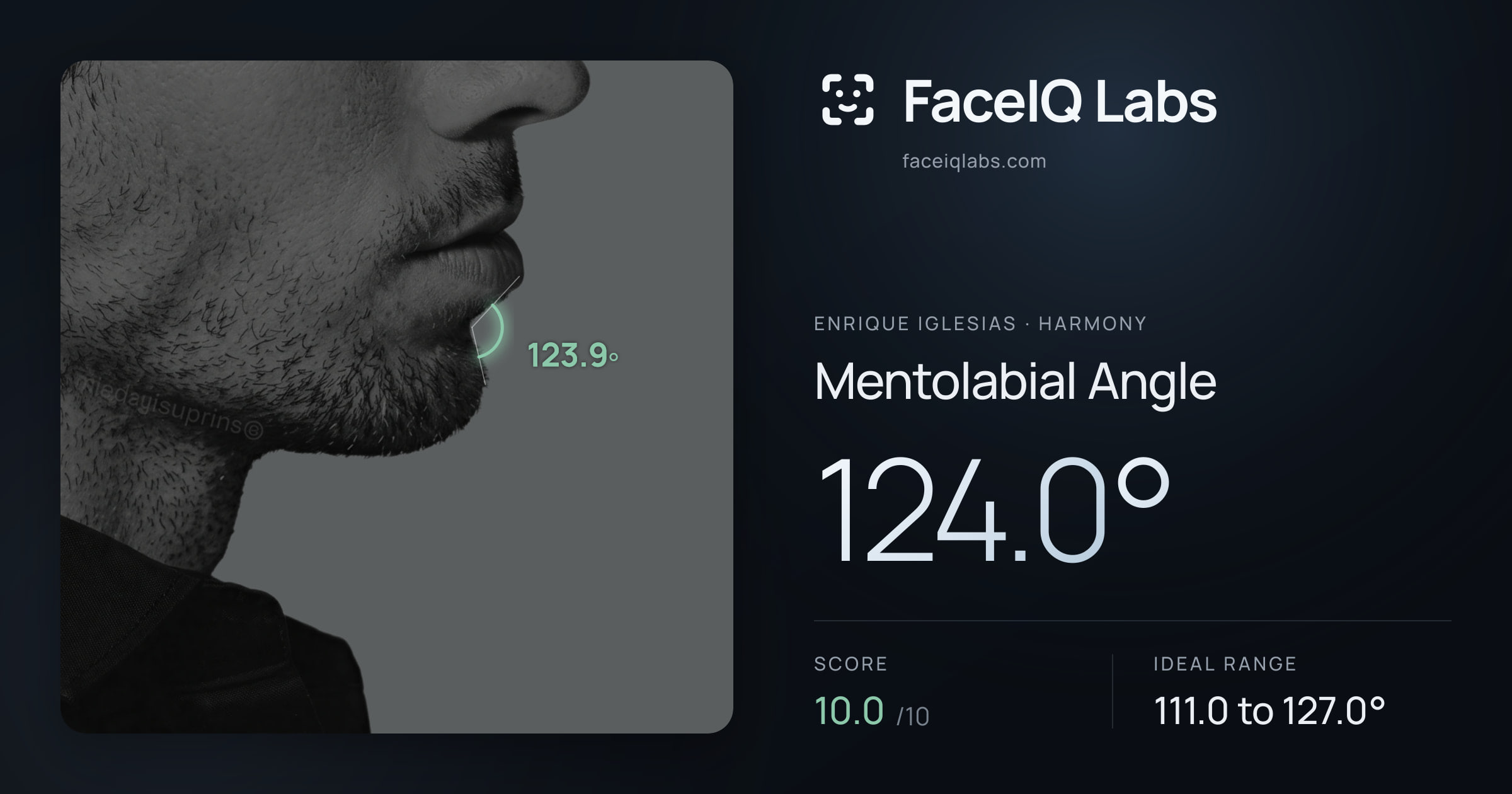 Enrique Iglesias Mentolabial Angle: 124.0°, drawn on the photo