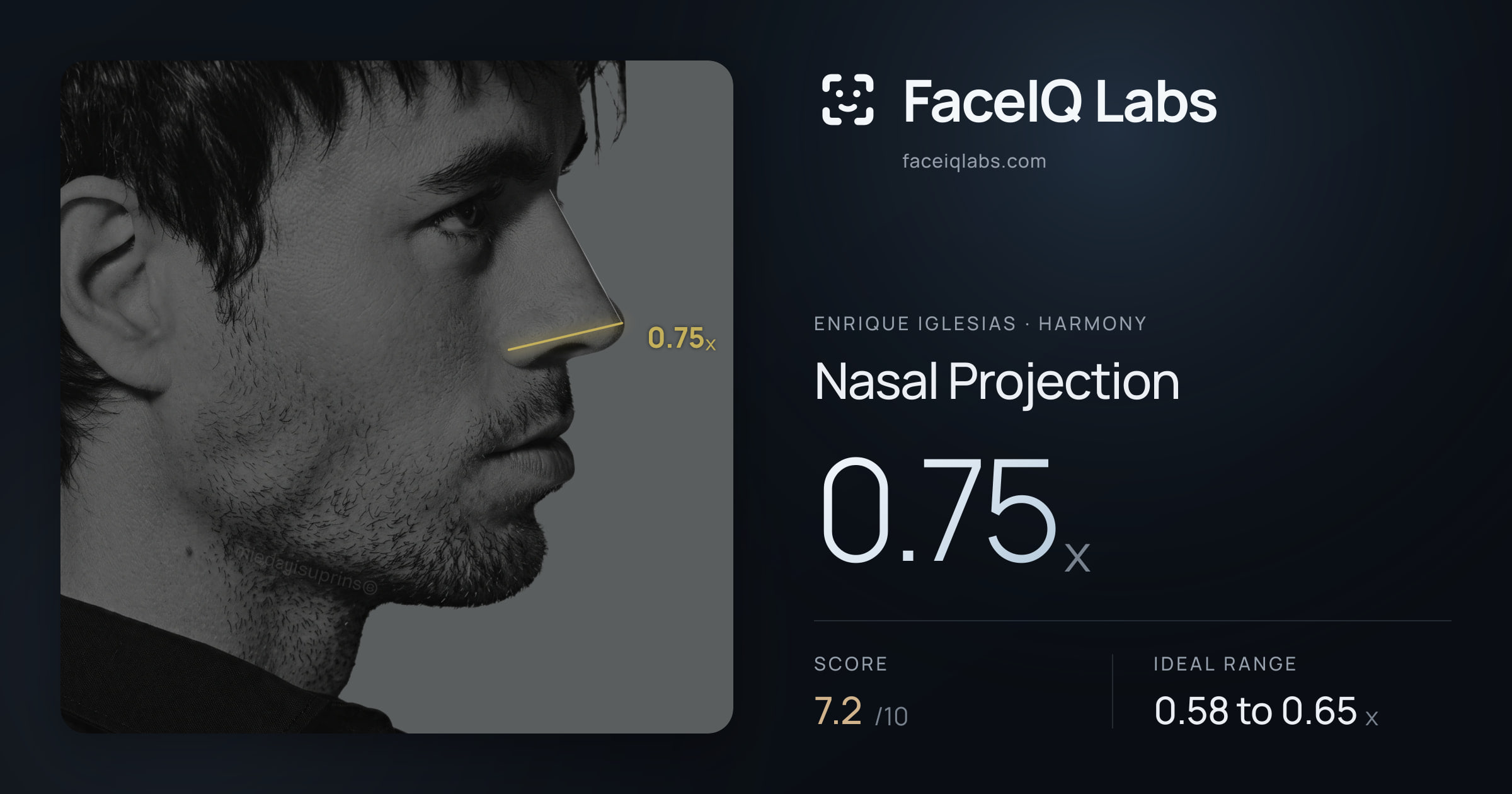 Enrique Iglesias Nasal Projection: 0.75x, drawn on the photo