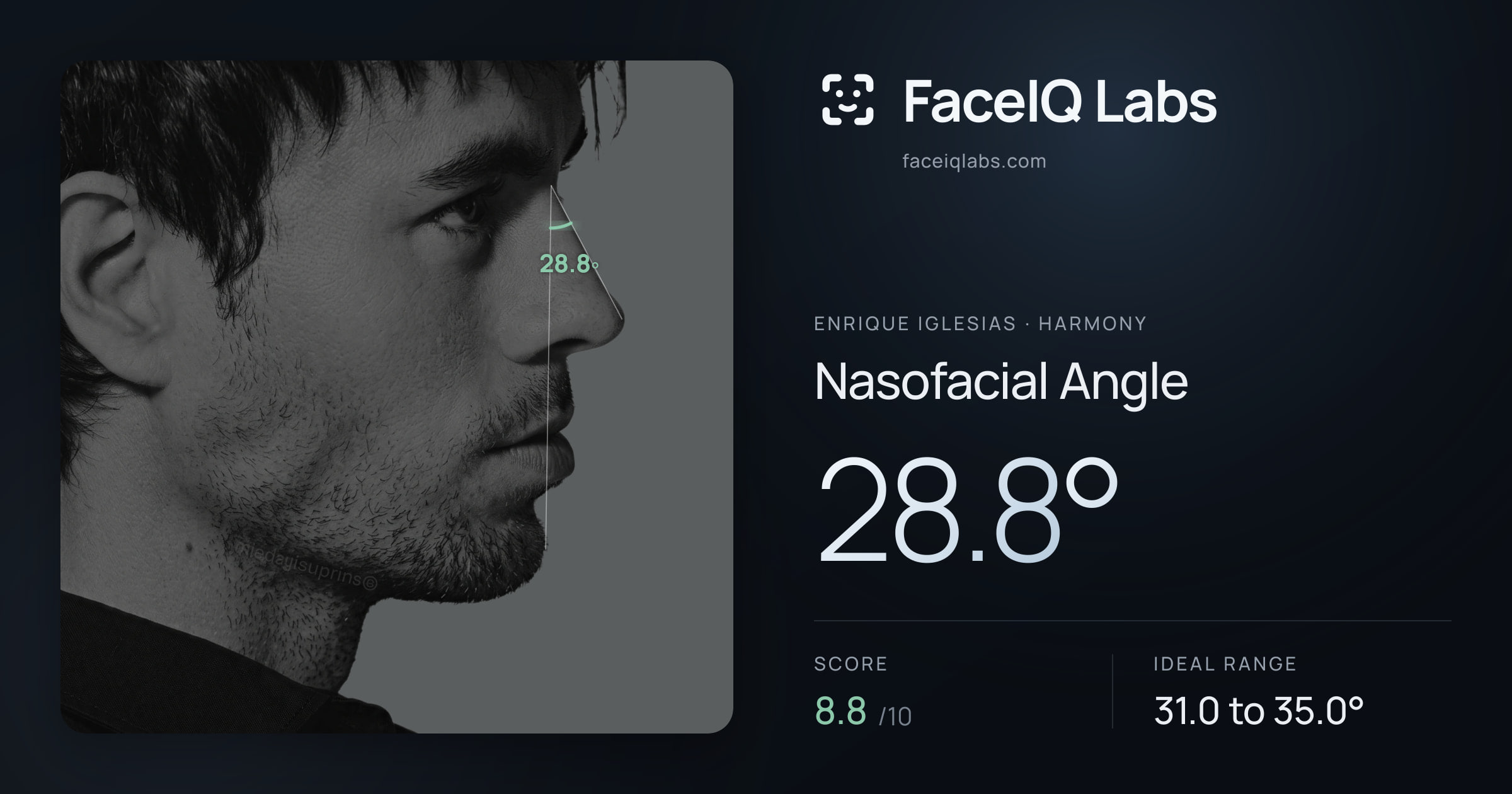 Enrique Iglesias Nasofacial Angle: 28.8°, drawn on the photo