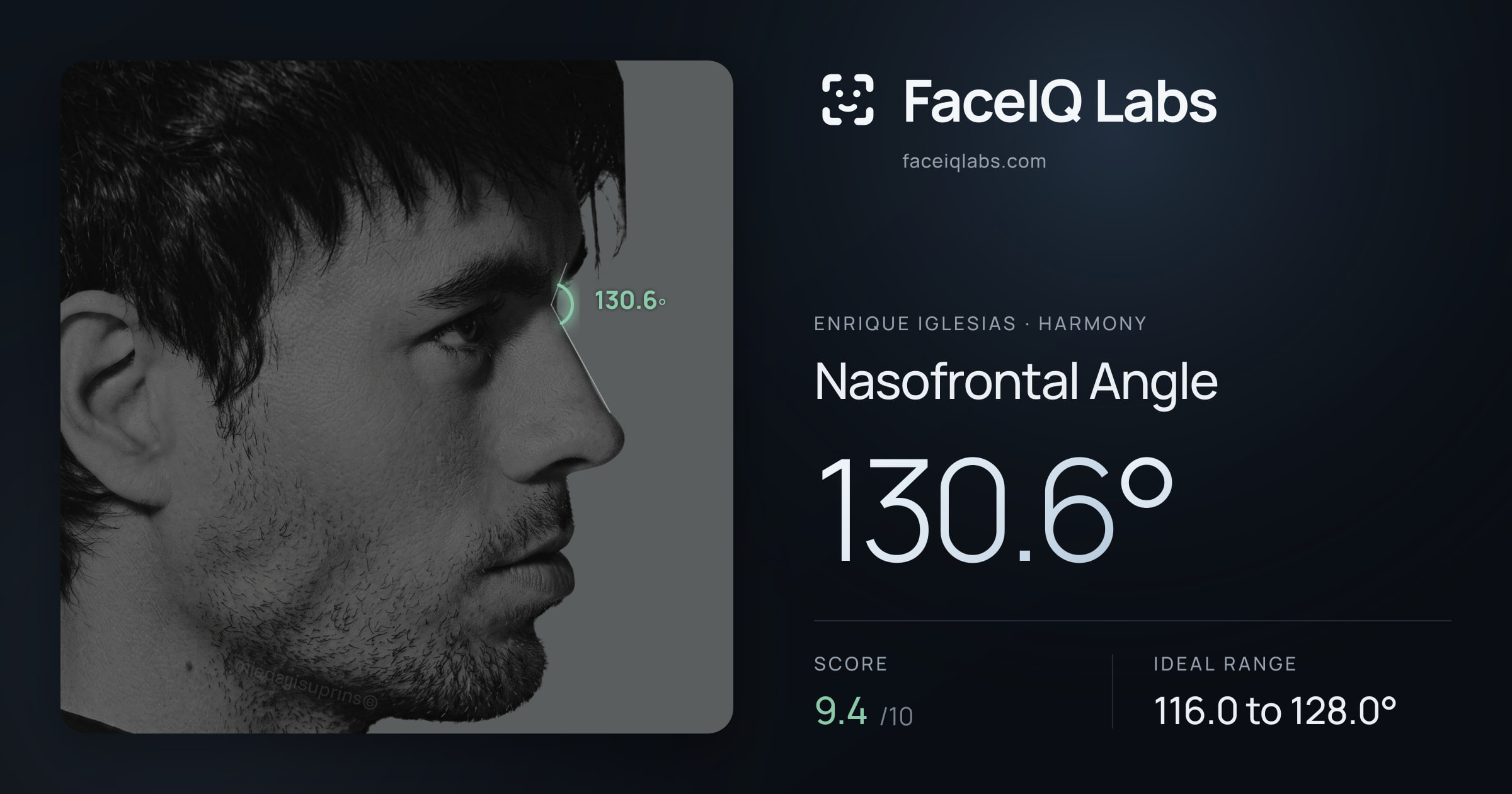 Enrique Iglesias Nasofrontal Angle: 130.6°, drawn on the photo