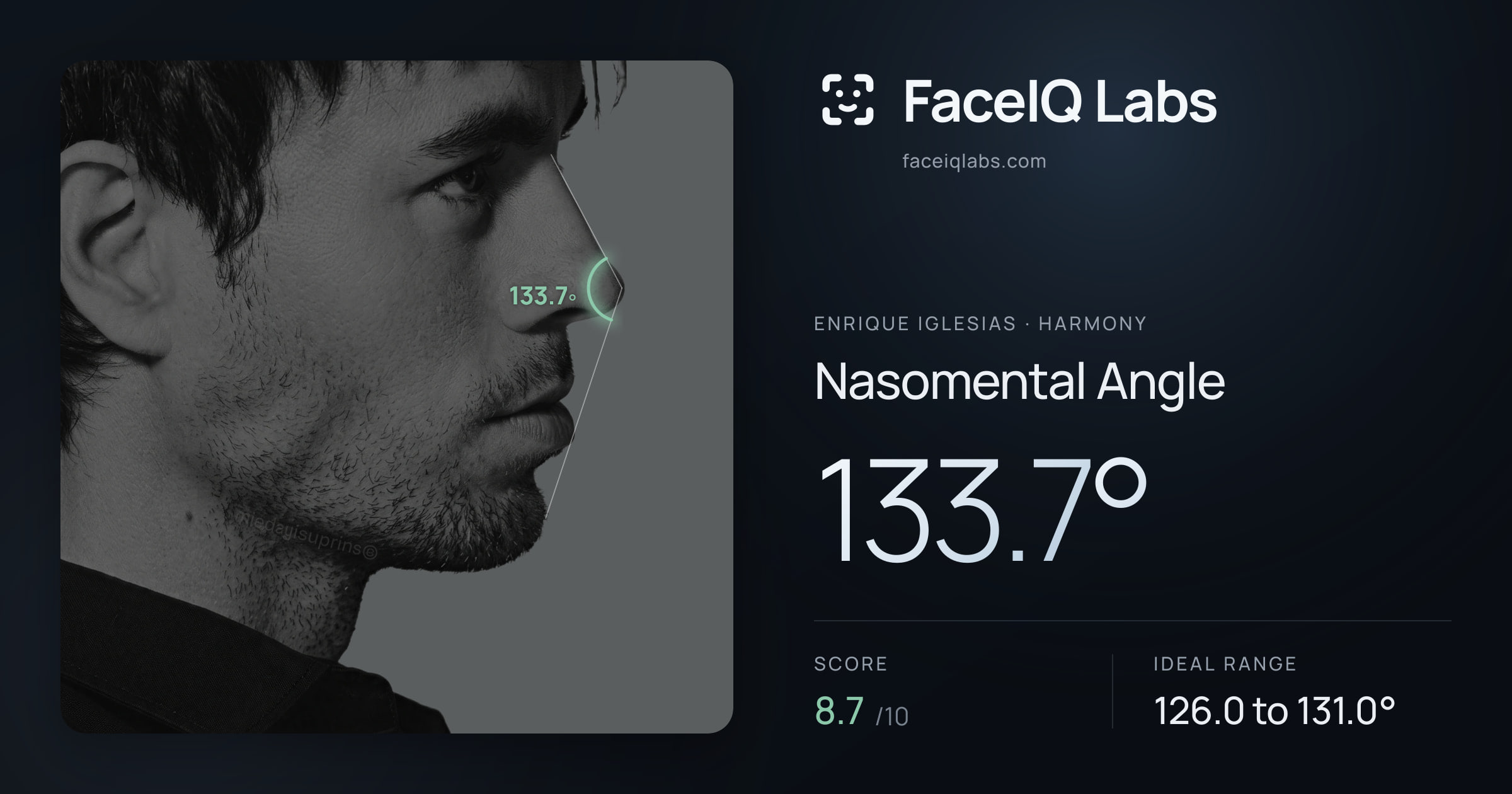 Enrique Iglesias Nasomental Angle: 133.7°, drawn on the photo