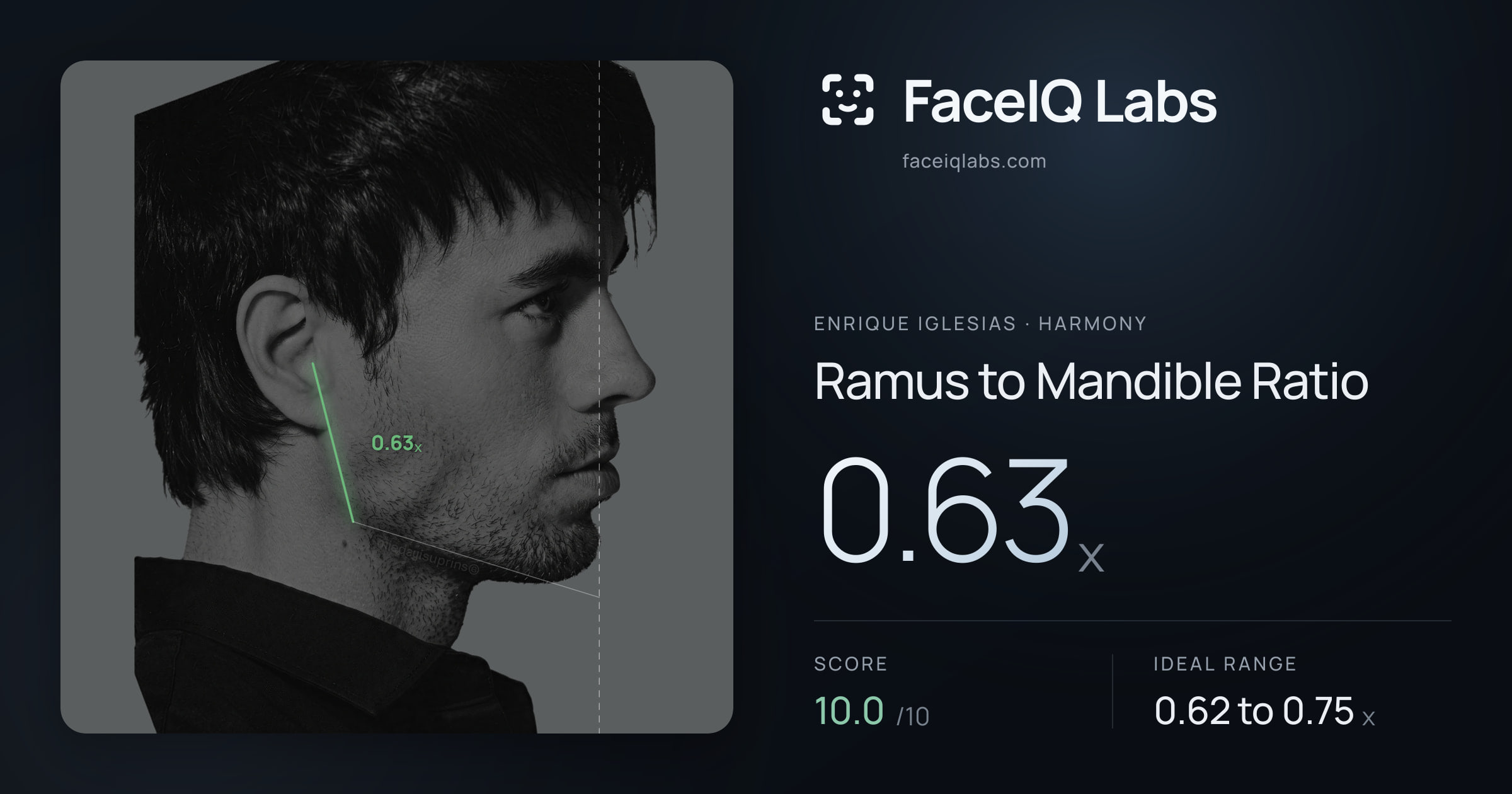 Enrique Iglesias Ramus to Mandible Ratio: 0.63x, drawn on the photo